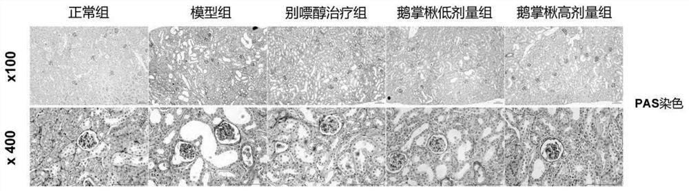 Application of liriodendron chinense or liriodendron chinense extract to preparation of medicine for reducing serum uric acid level and preventing and treating uric acid nephropathy