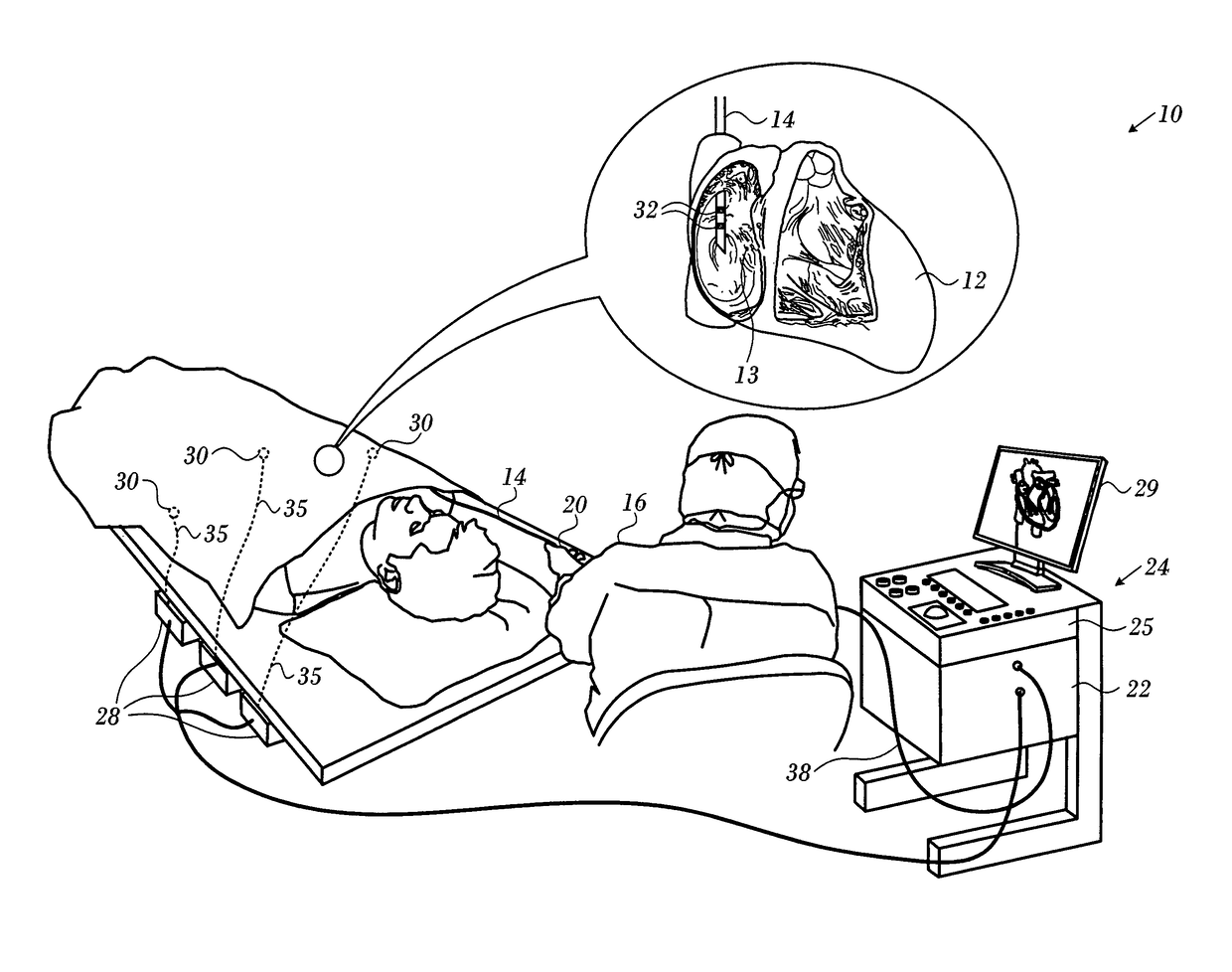 Global mapping catheter contact optimization