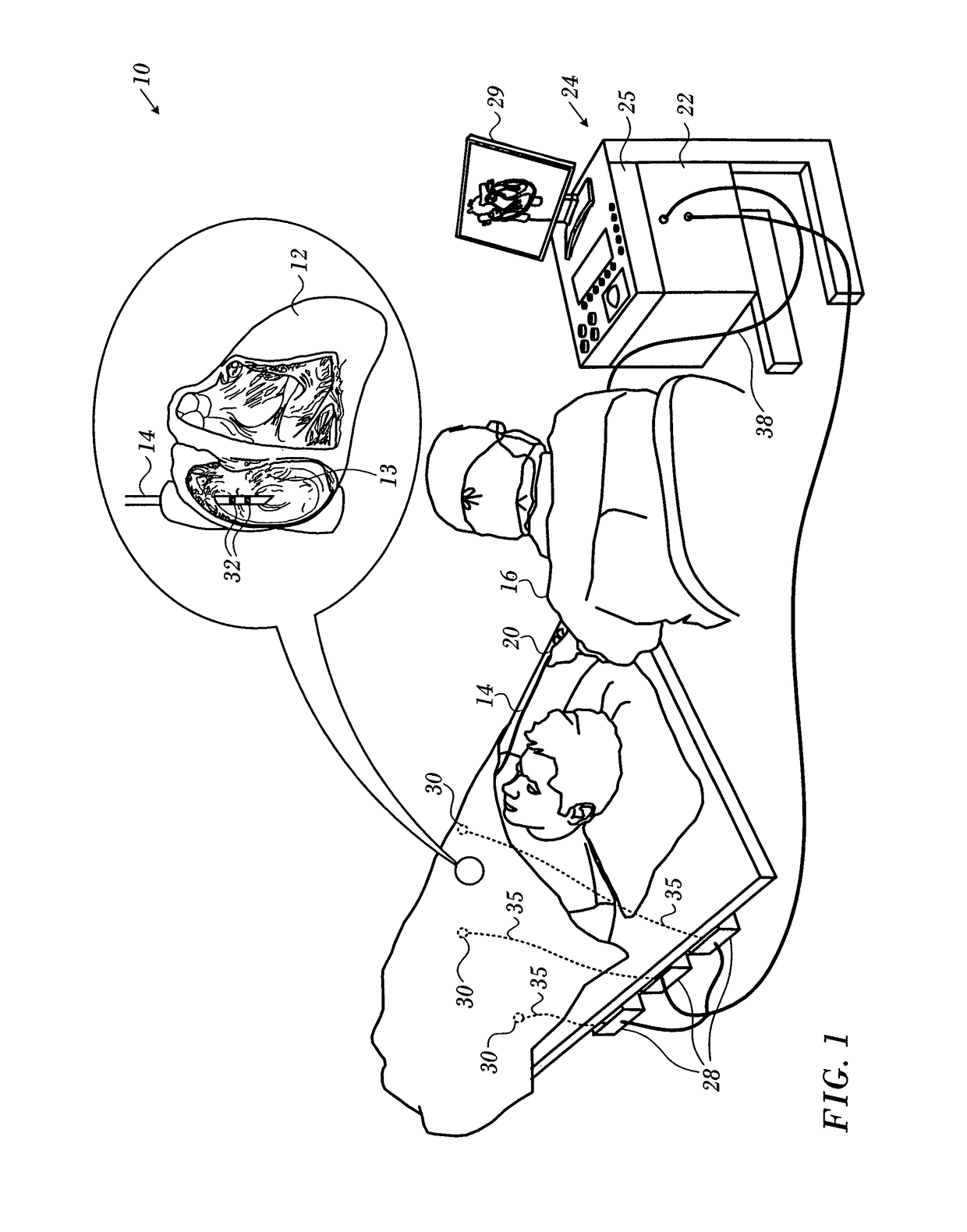 Global mapping catheter contact optimization