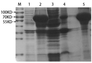 A kind of genetic engineering horseshoe crab blood g factor and its preparation method and application