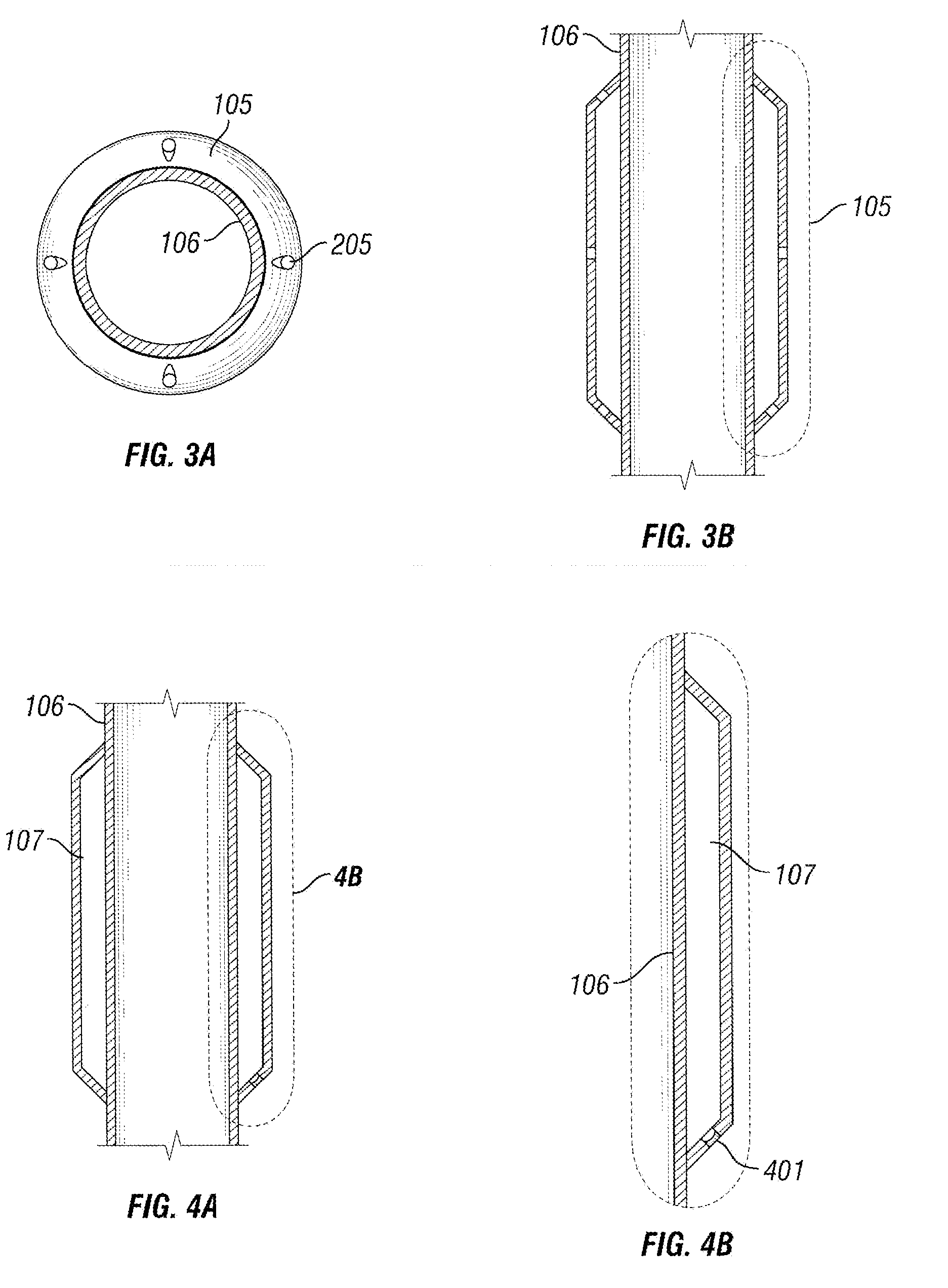 Systems and methods for mitigating annular pressure buildup in an oil or gas well