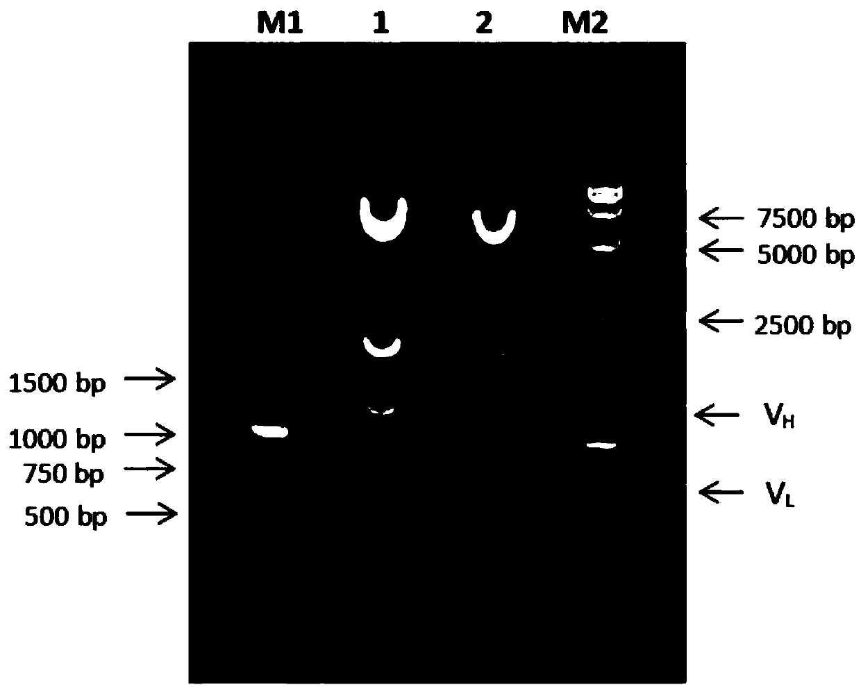 Screening method of GS (glutamine synthetase) expression system cell strains