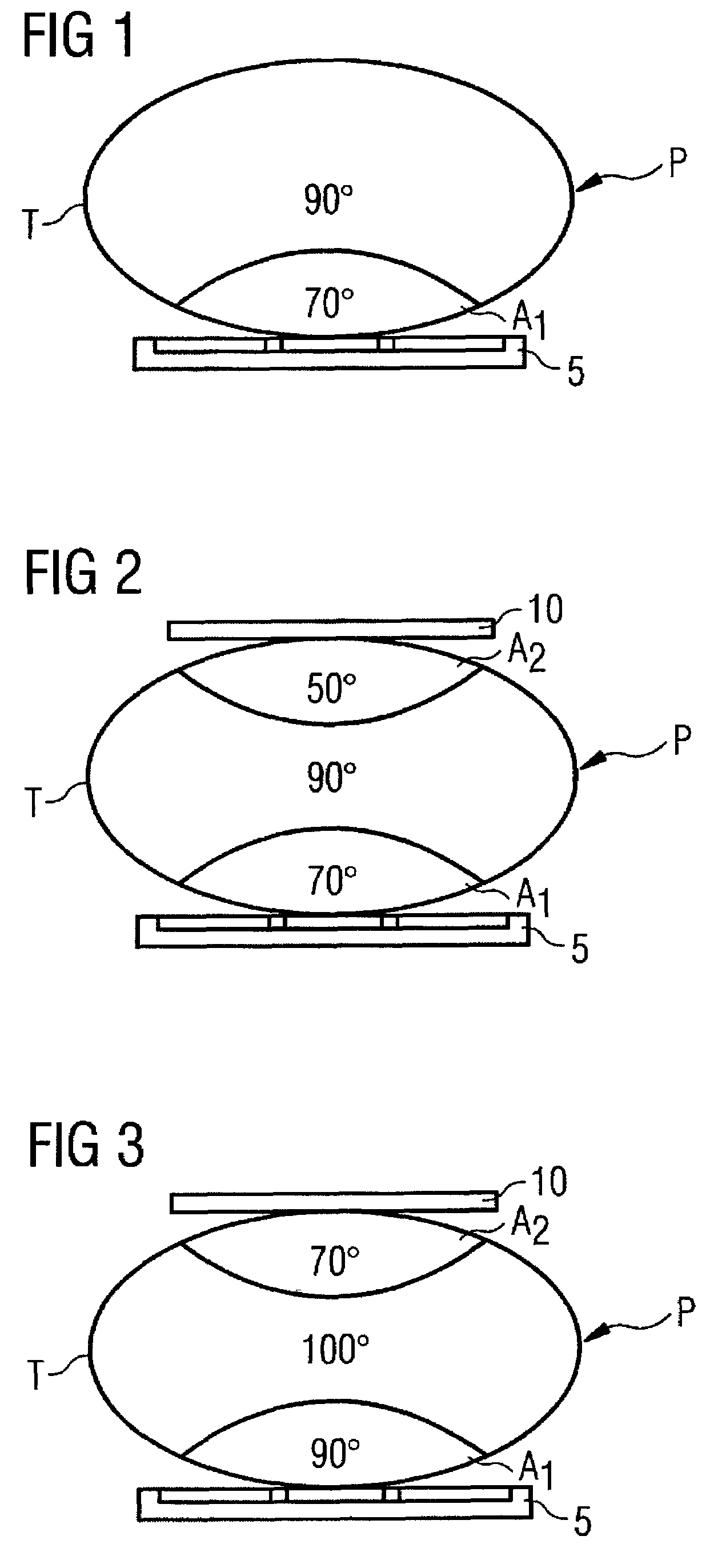 Magnetic resonance apparatus, method and auxilliary coil element for manipulation of the B1 field