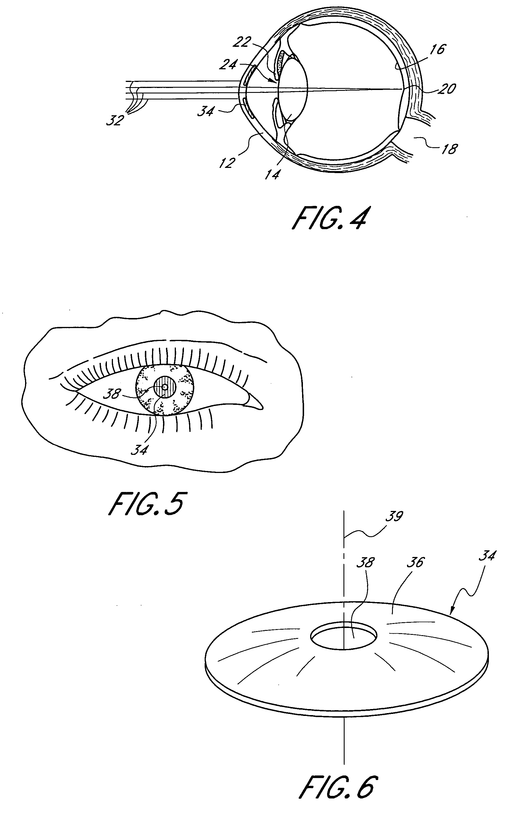 Method and apparatus for aligning a mask with the visual axis of an eye