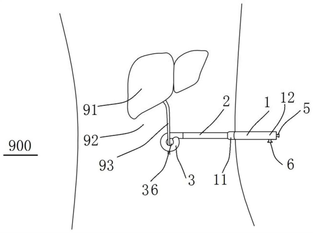 Tube flow control device for laparoscopic surgery