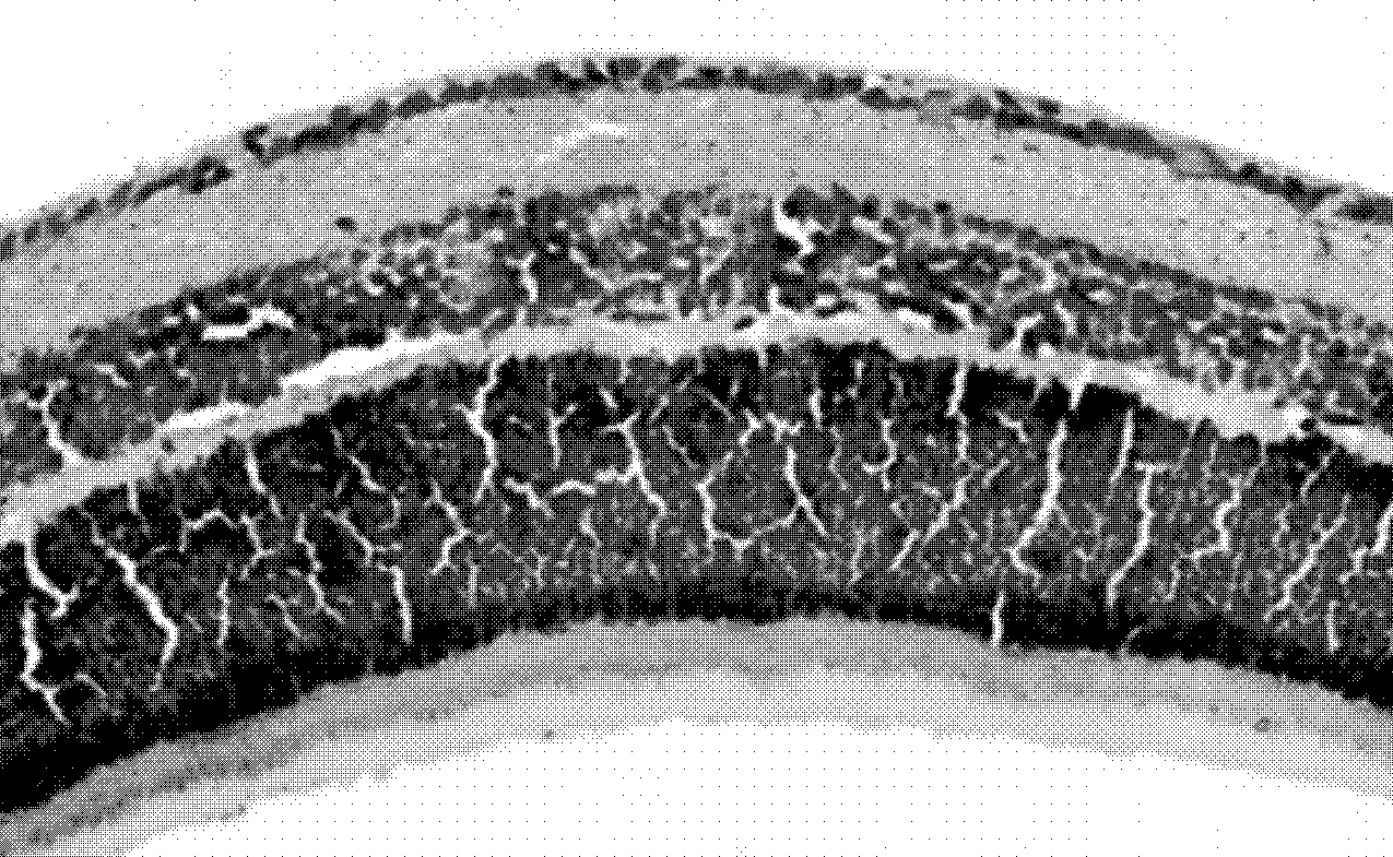 Application of drug composition in drug preparation for preventing or treating neovascular diseases