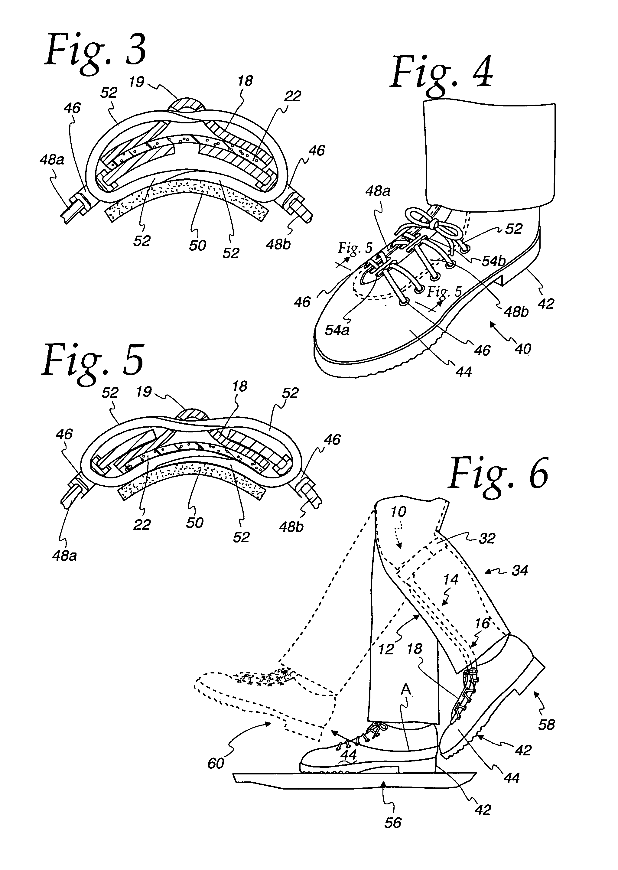 Ankle-foot orthotic device and method