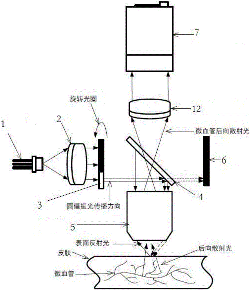 Sidestream dark field imaging technique-based human body microvessel three-dimensional ultrastructure imaging system