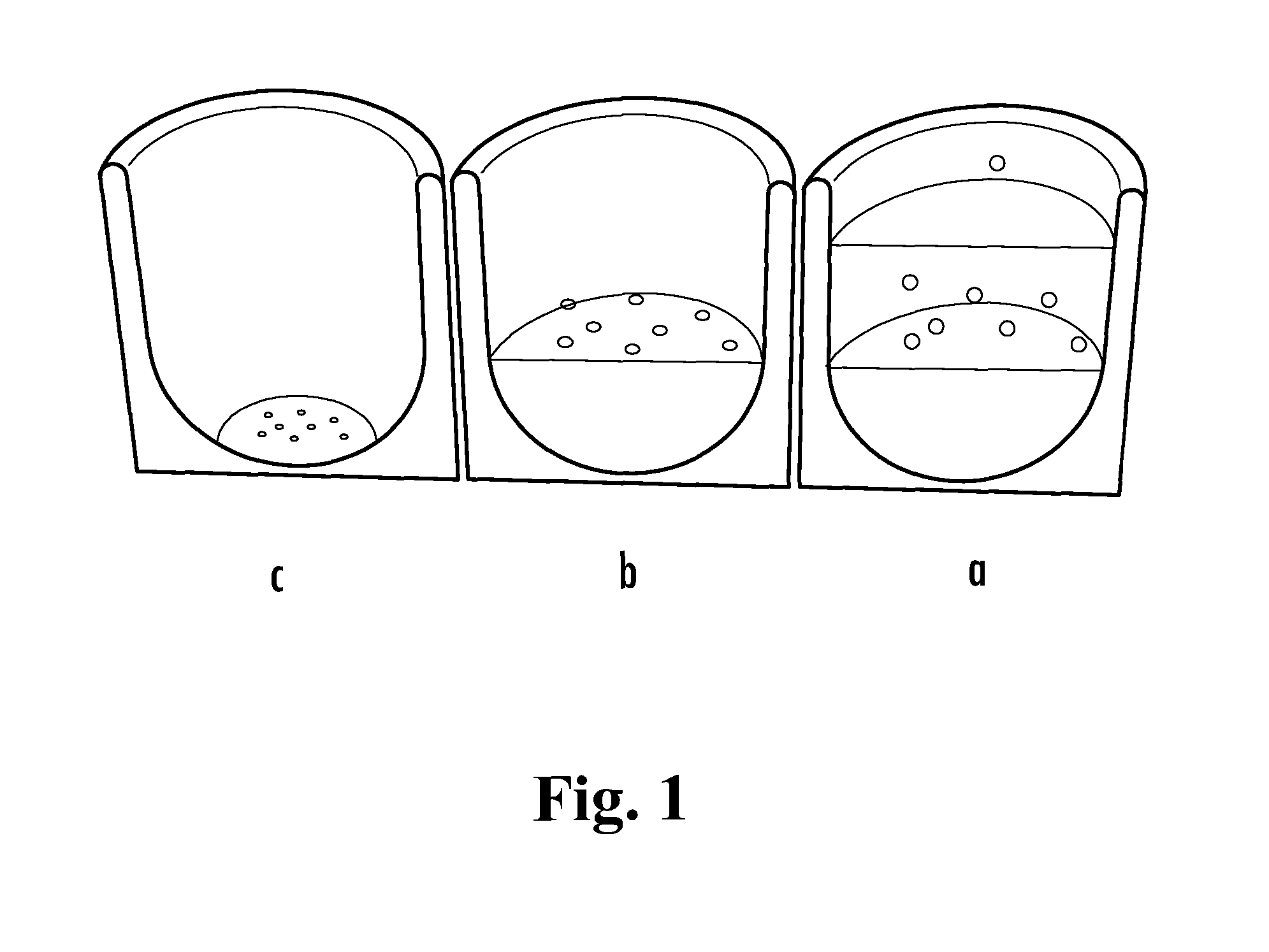 Loadable polymeric particles for enhanced imaging in clinical applications and methods of preparing and using the same