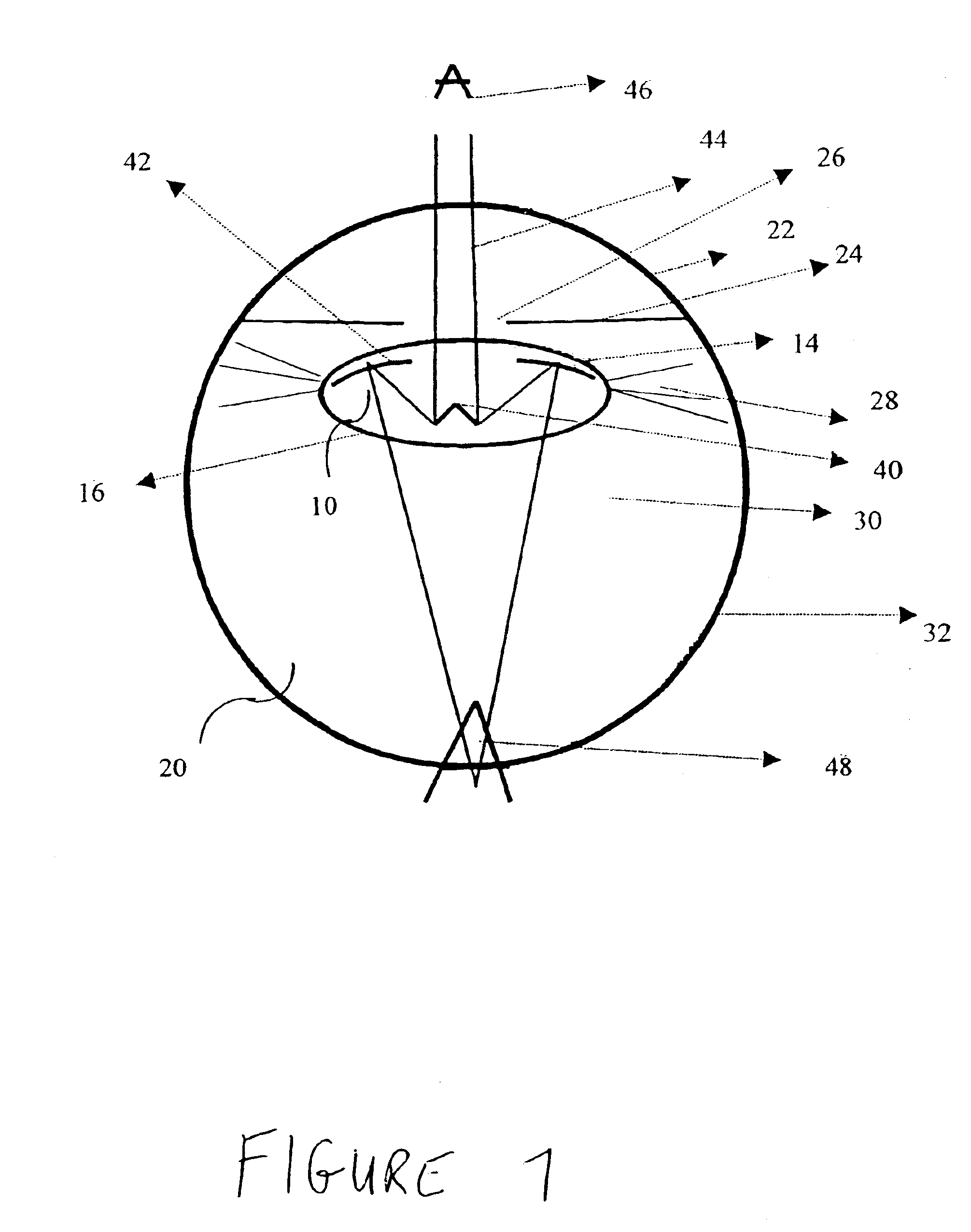 Intraocular lens implant with mirror