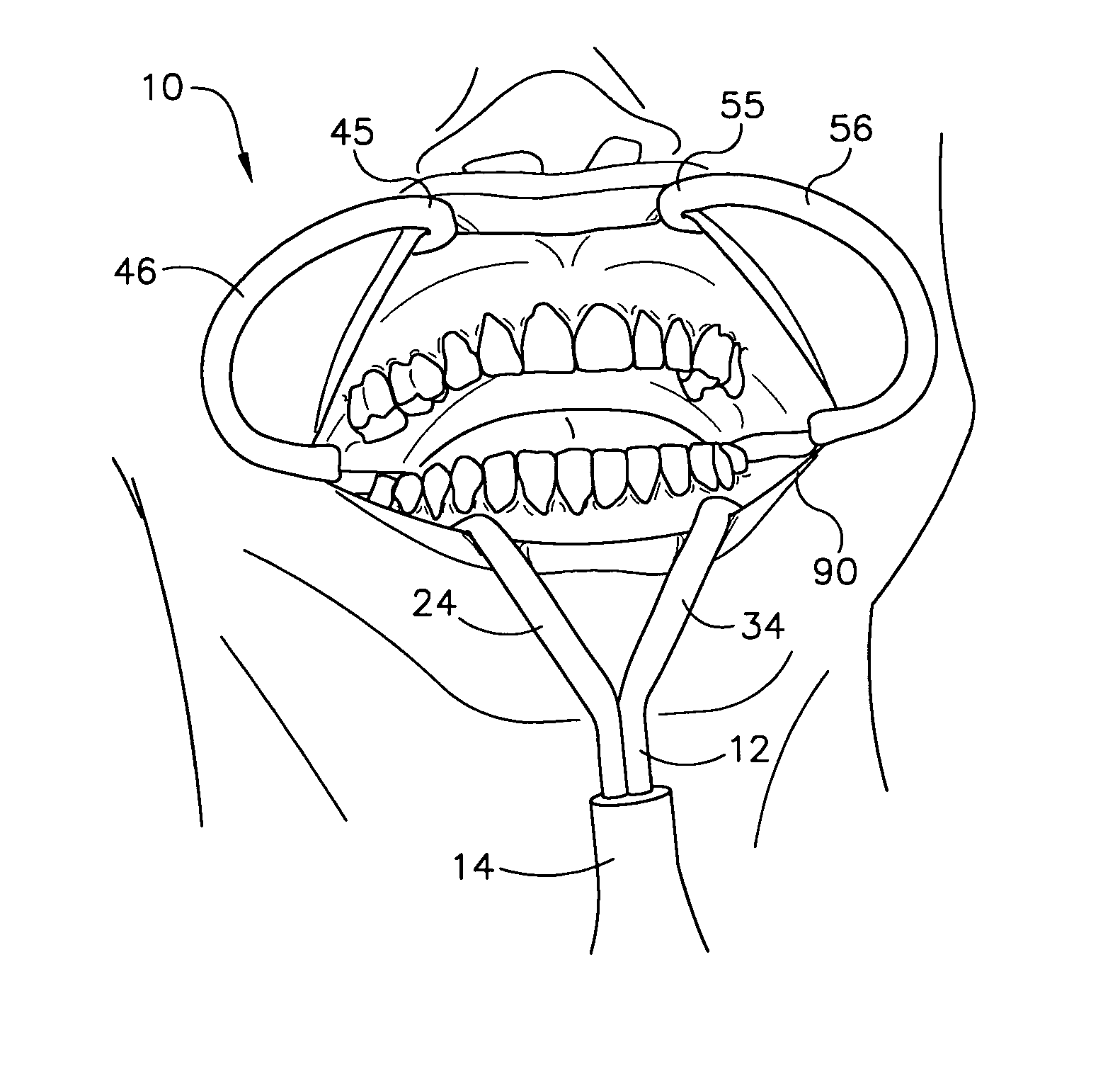 Combined mouth expanding and saliva ejecting dental apparatus