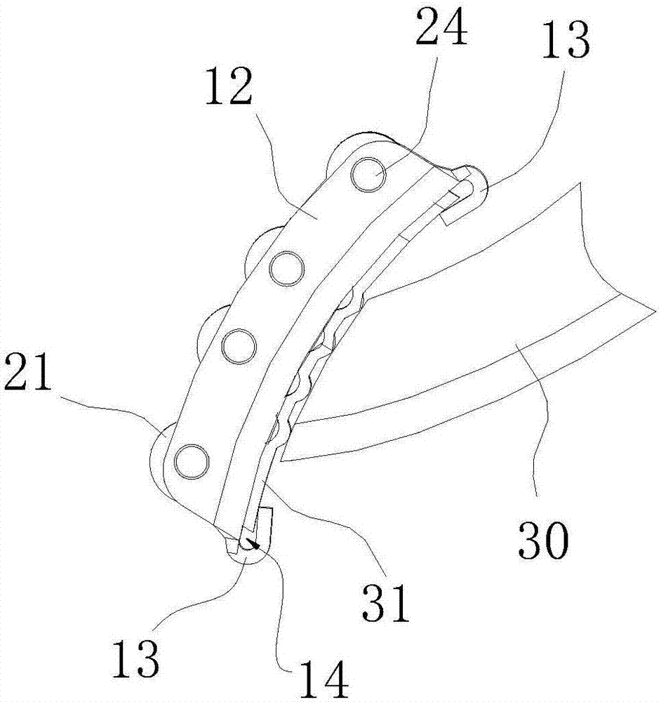 Vehicle pedal