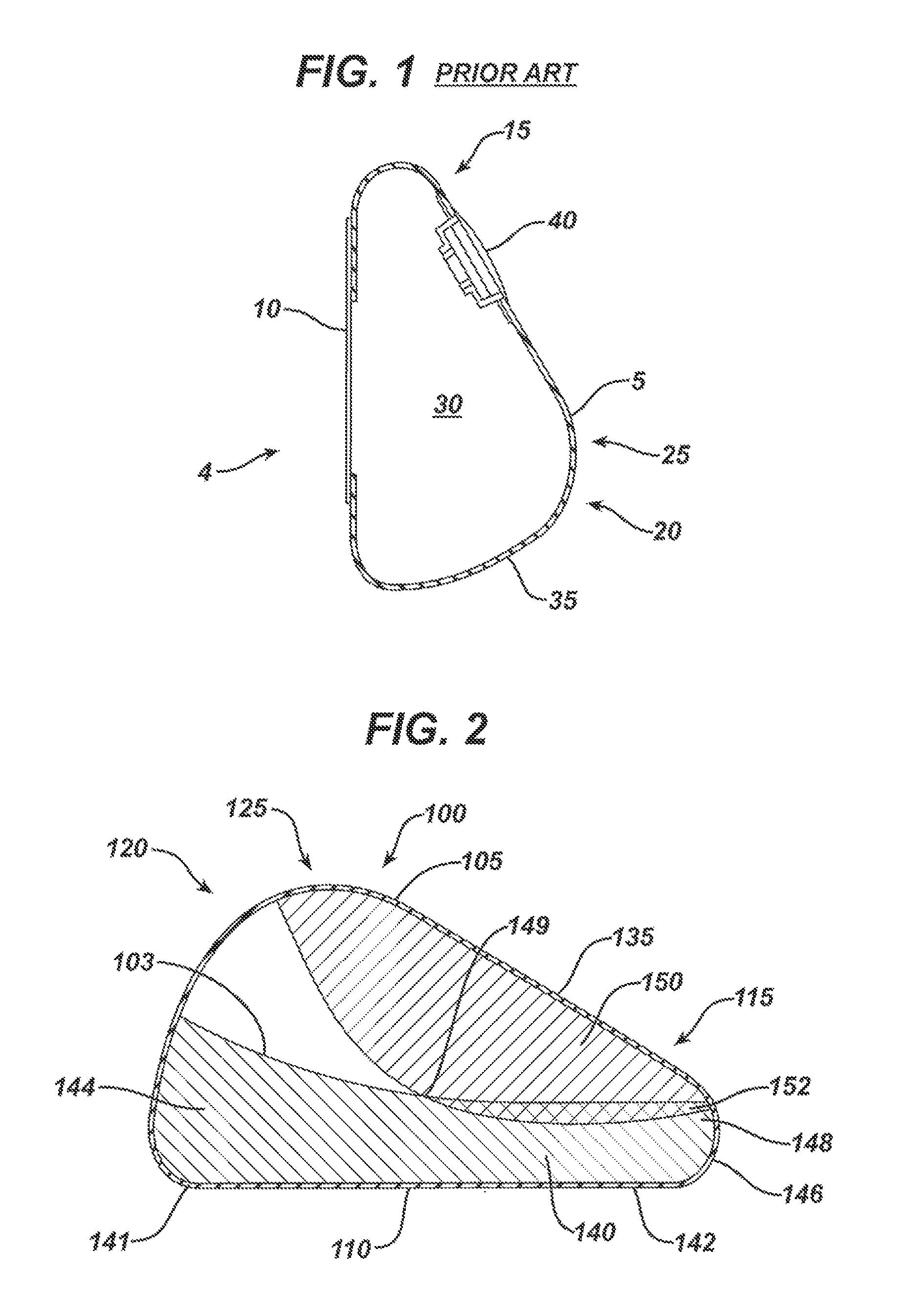 Directional tissue expander