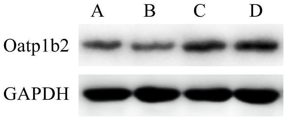 Traditional Chinese medicine composition containing guiding drug achyranthes bidentata for treating Yin deficiency and heat excess type non-alcoholic fatty liver disease and preparation method and application thereof