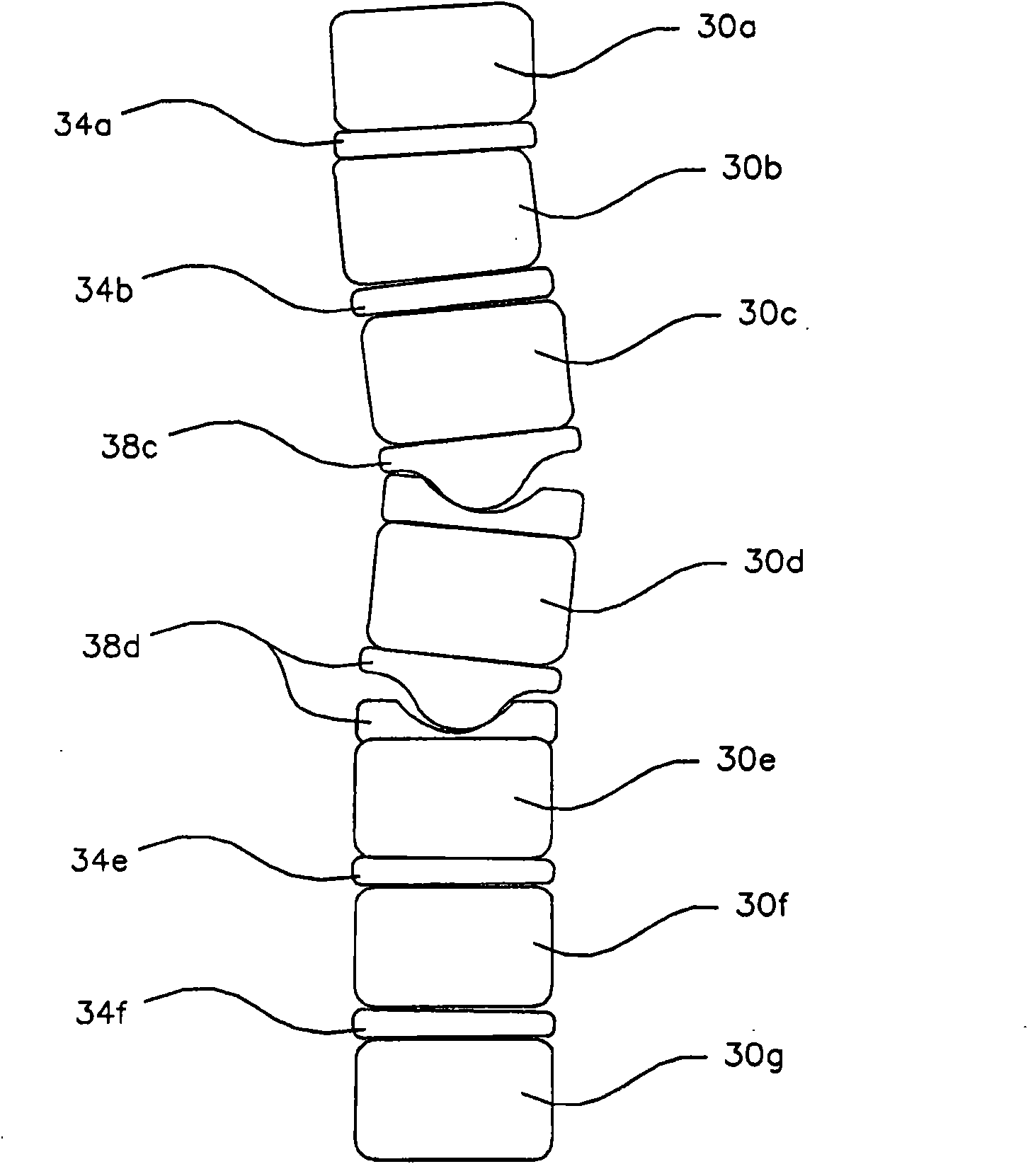 Multi-lobe artificial spine joint