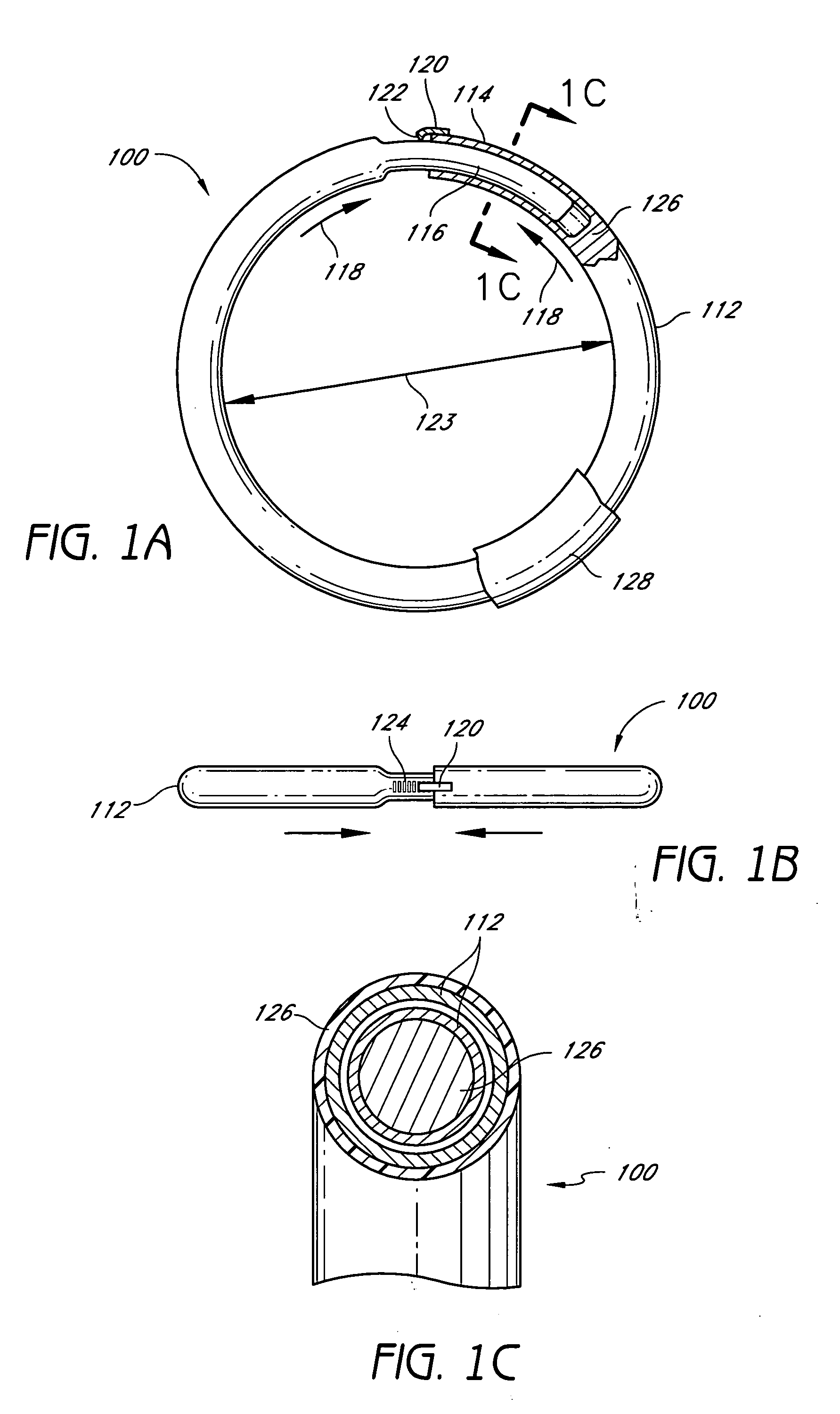 Methods for treating cardiac valves with adjustable implants