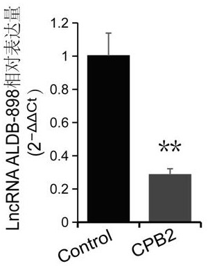 A lncRNA ALDB-898 associated with piglet bacterial diarrhea and its application