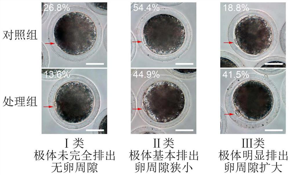 A culture medium for promoting porcine oocyte maturation in vitro