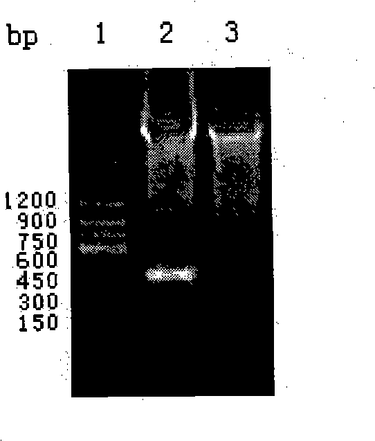 Expression vector and fused protein of human differential initiator 3 and preparation thereof