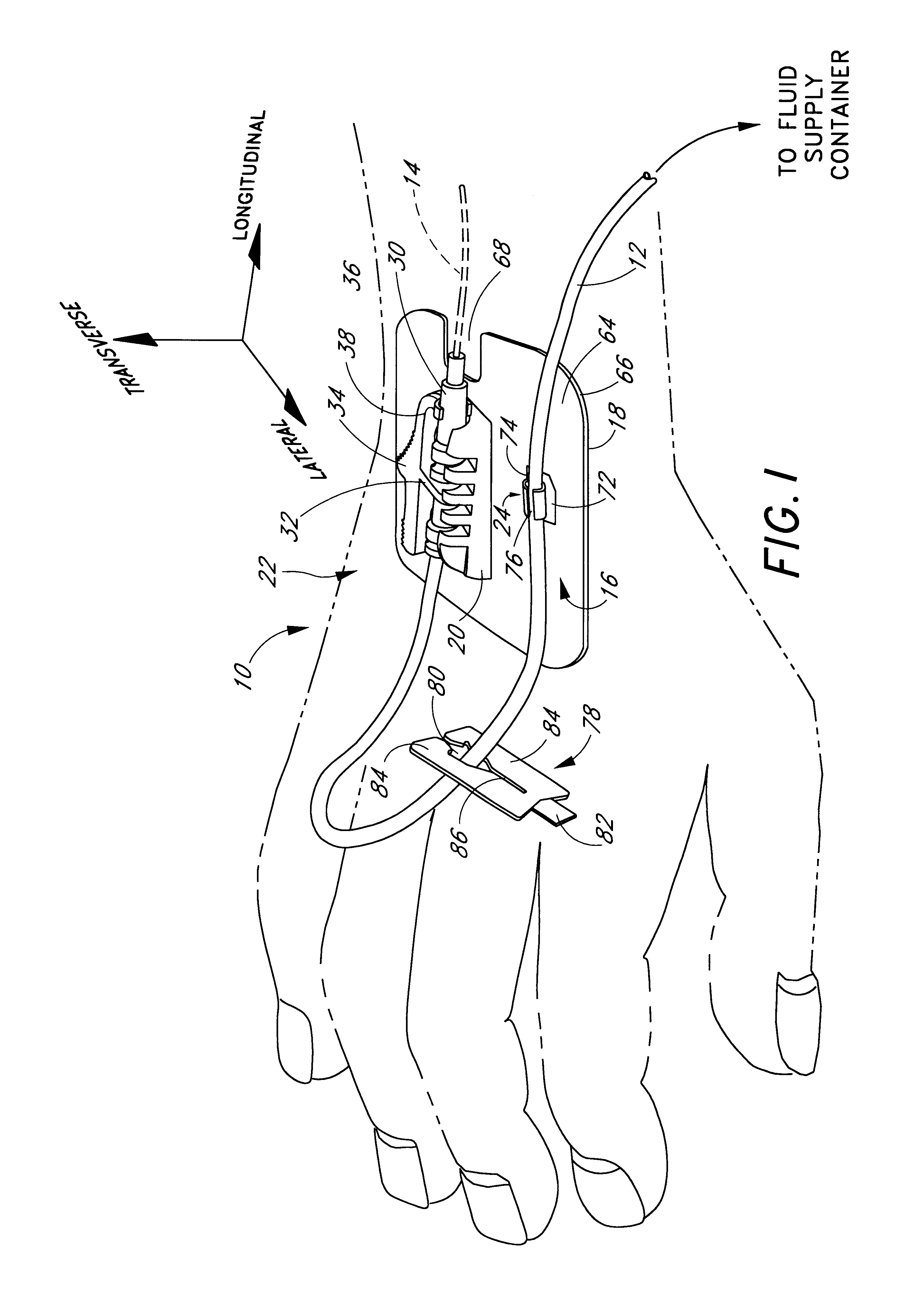 Catheter anchoring system