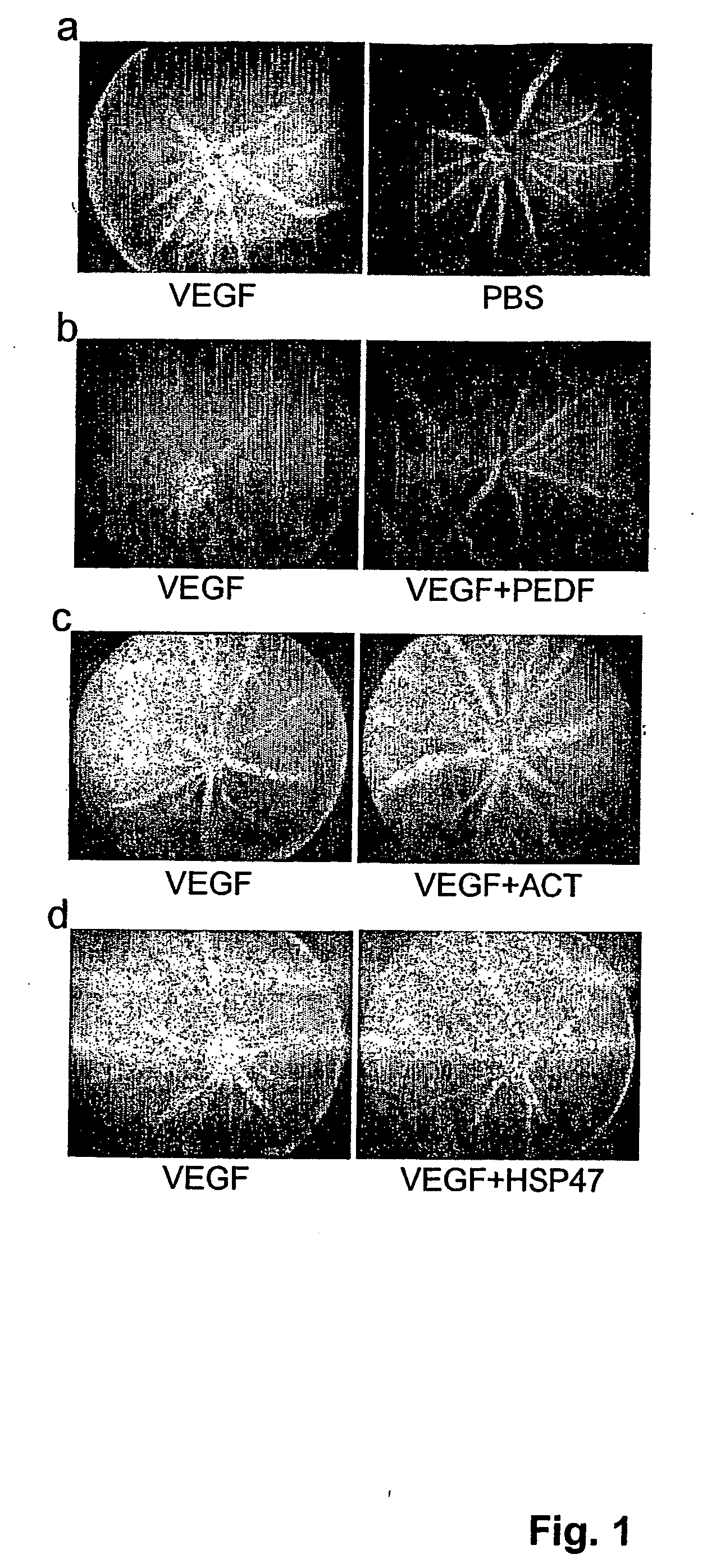 Pigment epithelium-derived factor as a therapeutic agent for vascular leakage