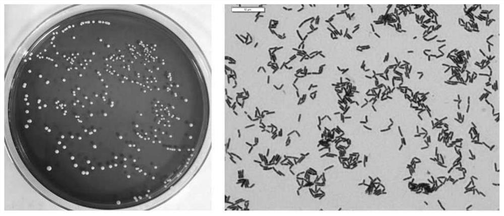 A strain of Lactobacillus plantarum with weight loss function and its application