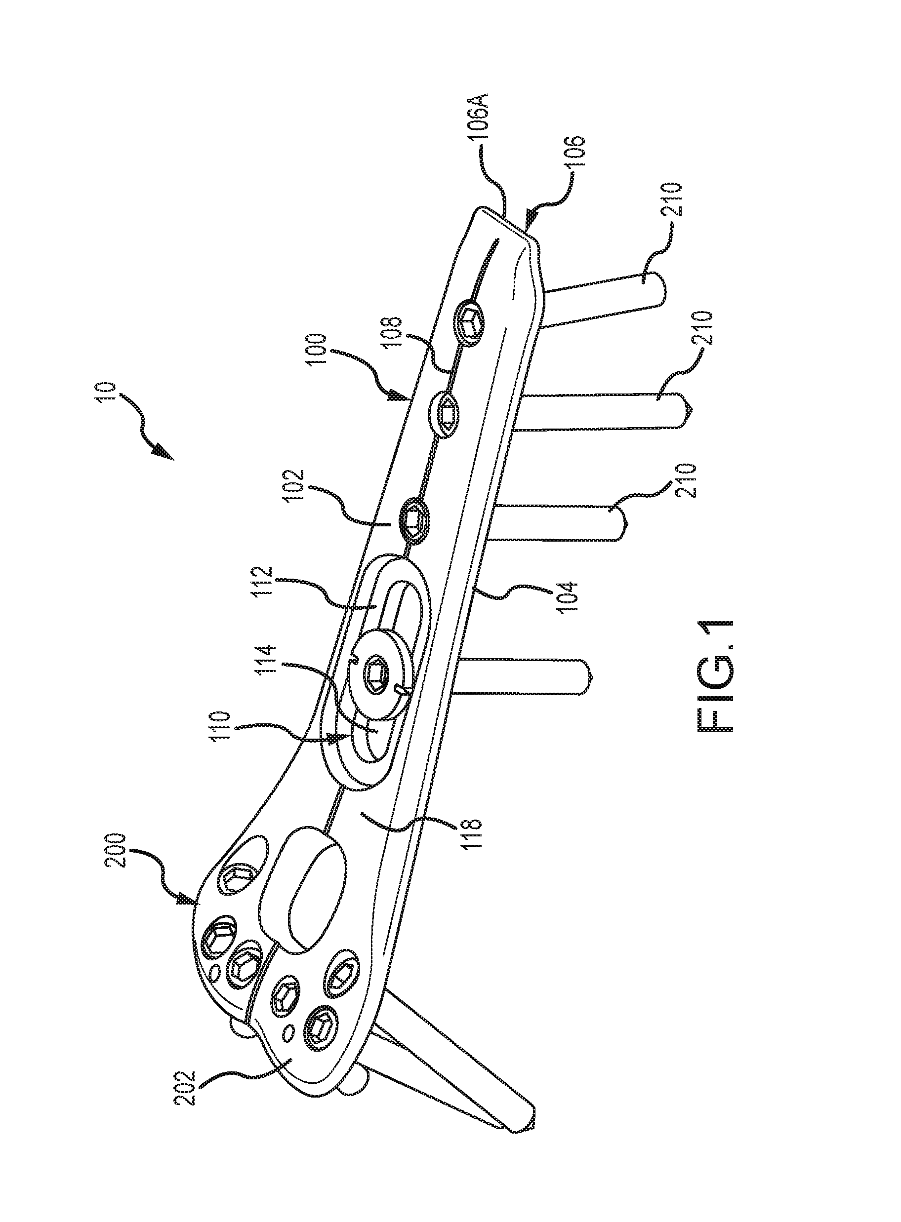 Distal radius plate