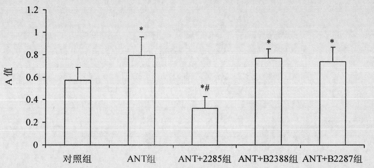 Preparation method for B cell CD 22 extracellular inhibitive peptide fragment B2285 vaccines