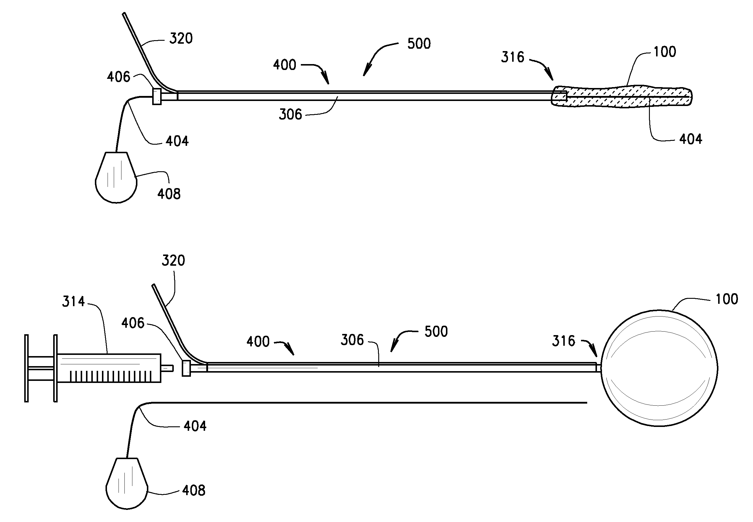 Ballstent device and methods of use
