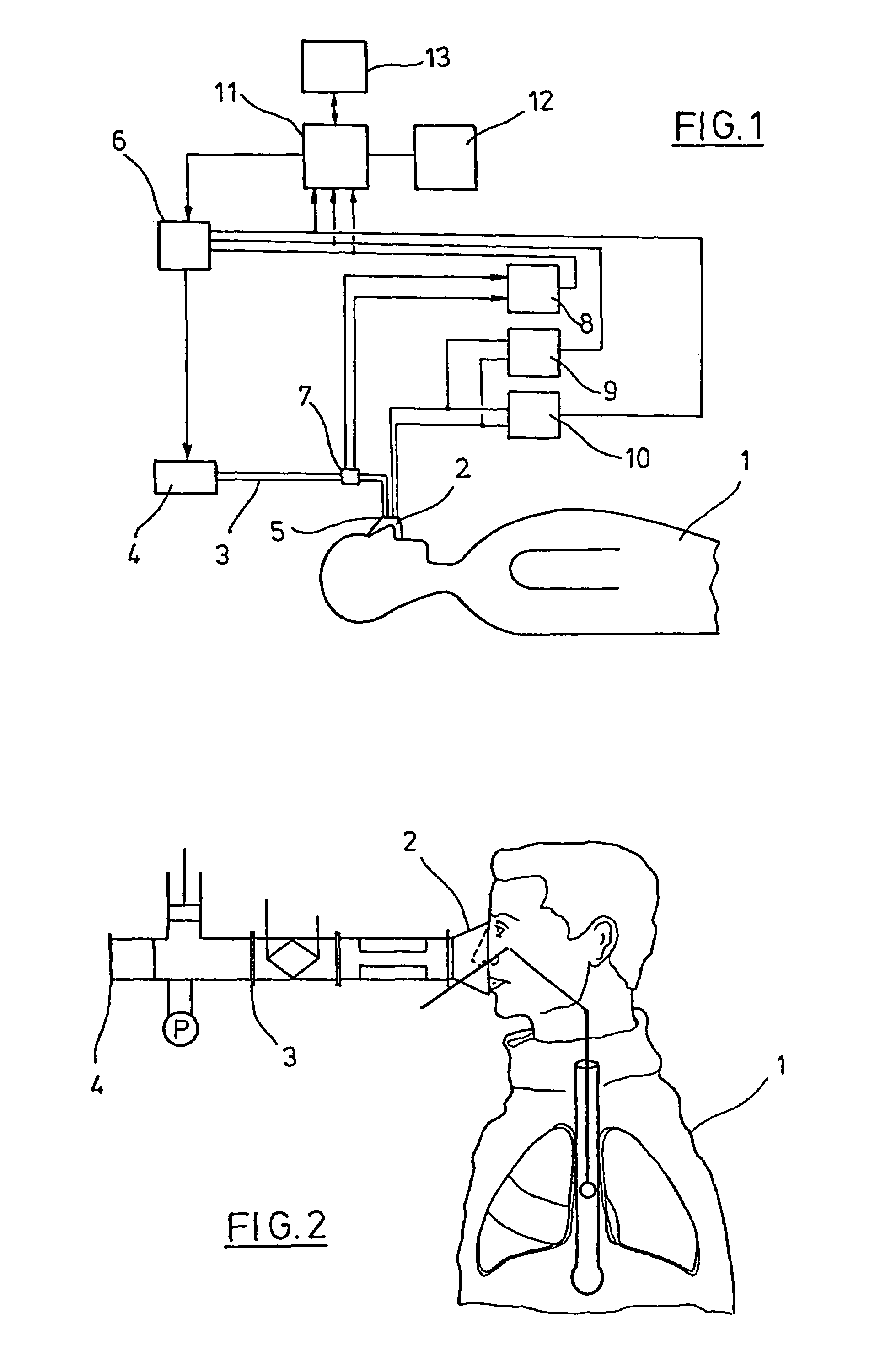 Procedure for the control of a respirator device as well as apparatus for monitoring
