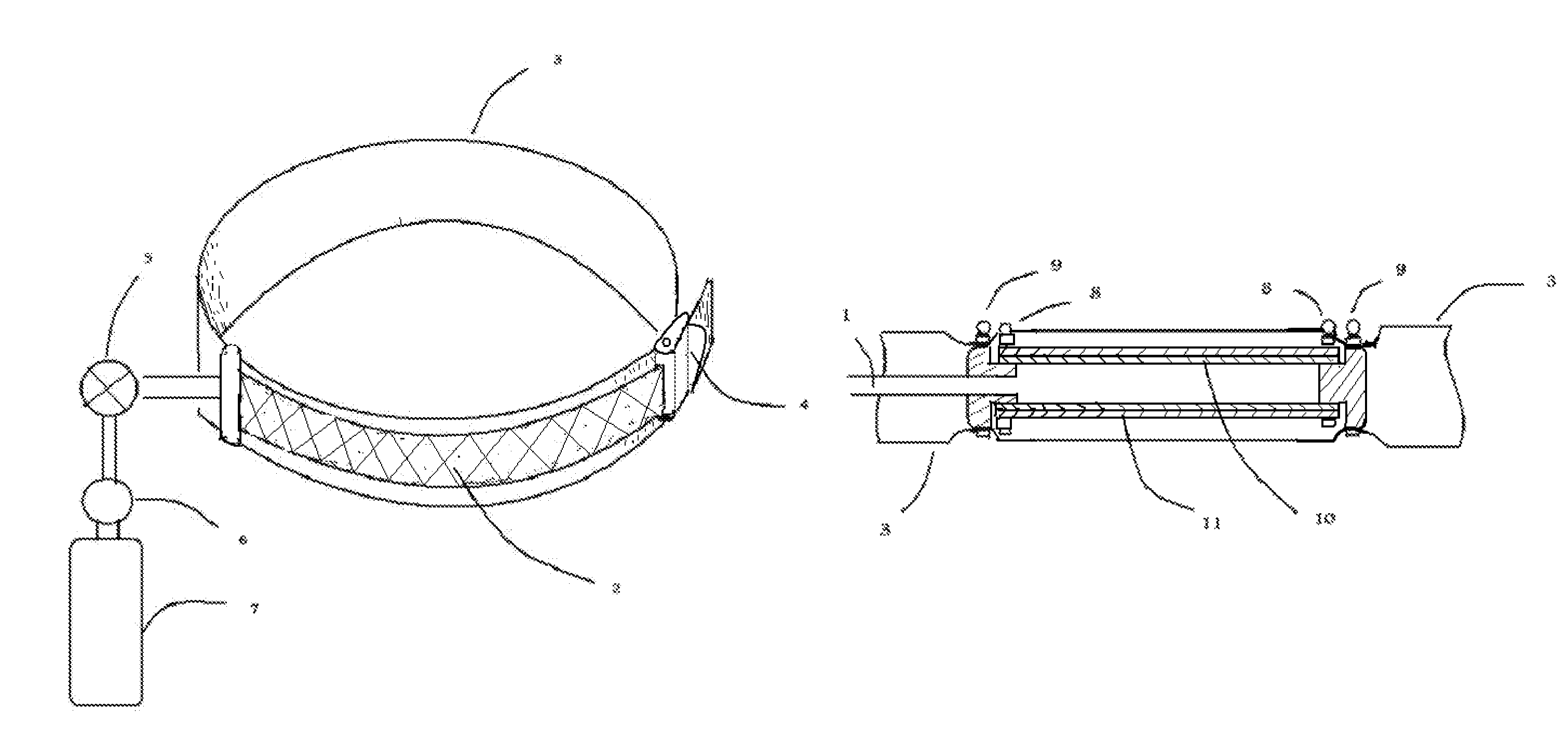 Body surface compression with pneumatic shortening element