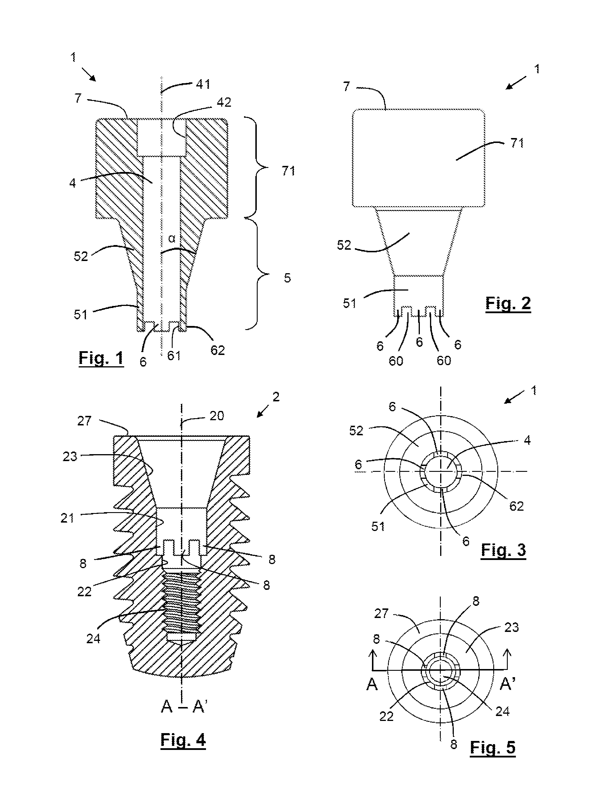 Dental abutment, abutment and screw assembly, and dental implant system