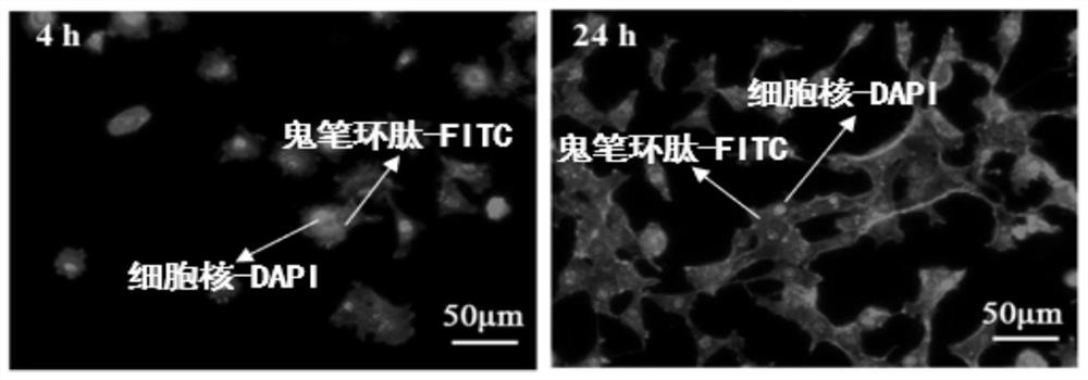 Composite material for processing miniature bone fixation nail and its preparation method