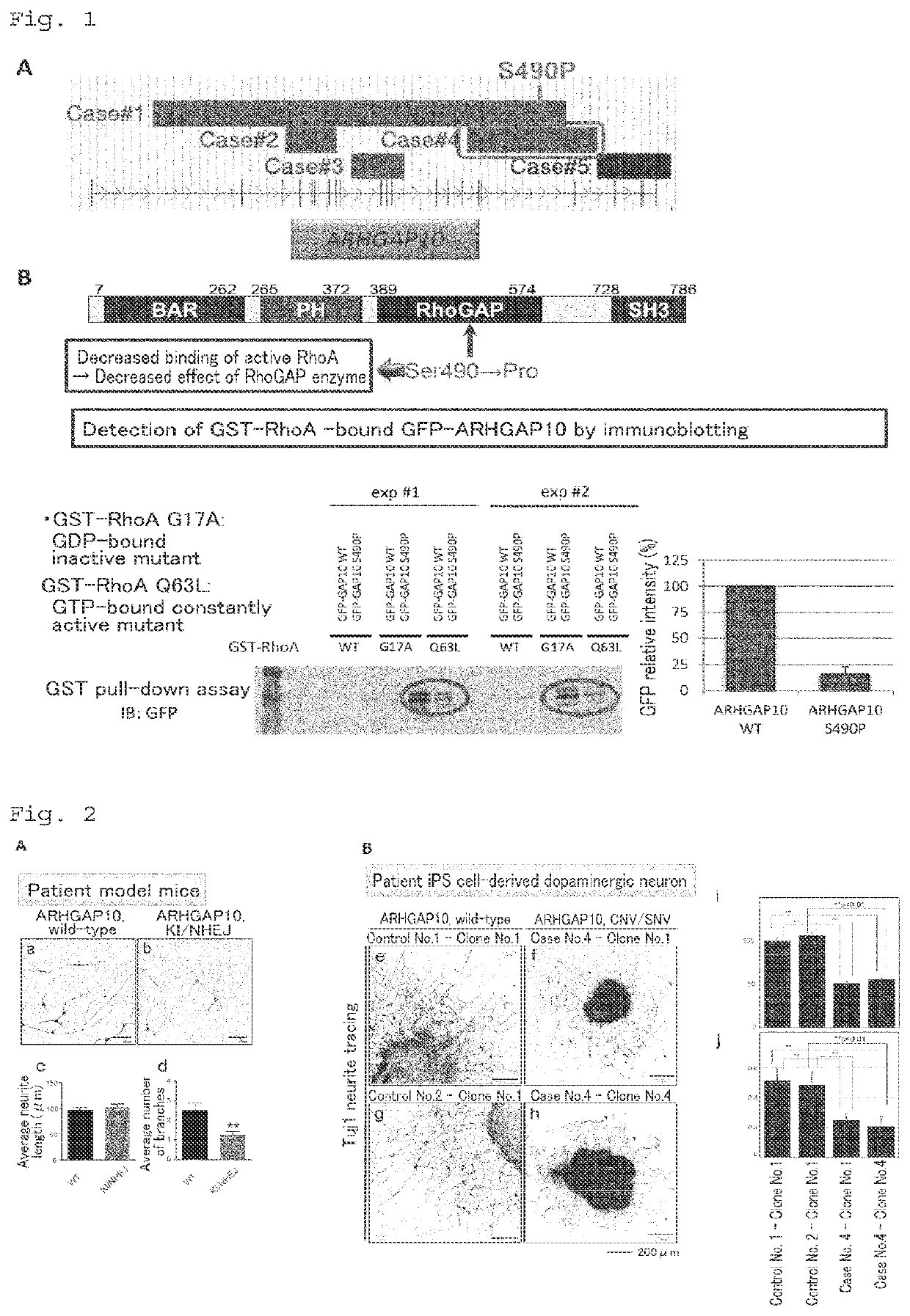 Fasudil for the treatment of schizophrenia