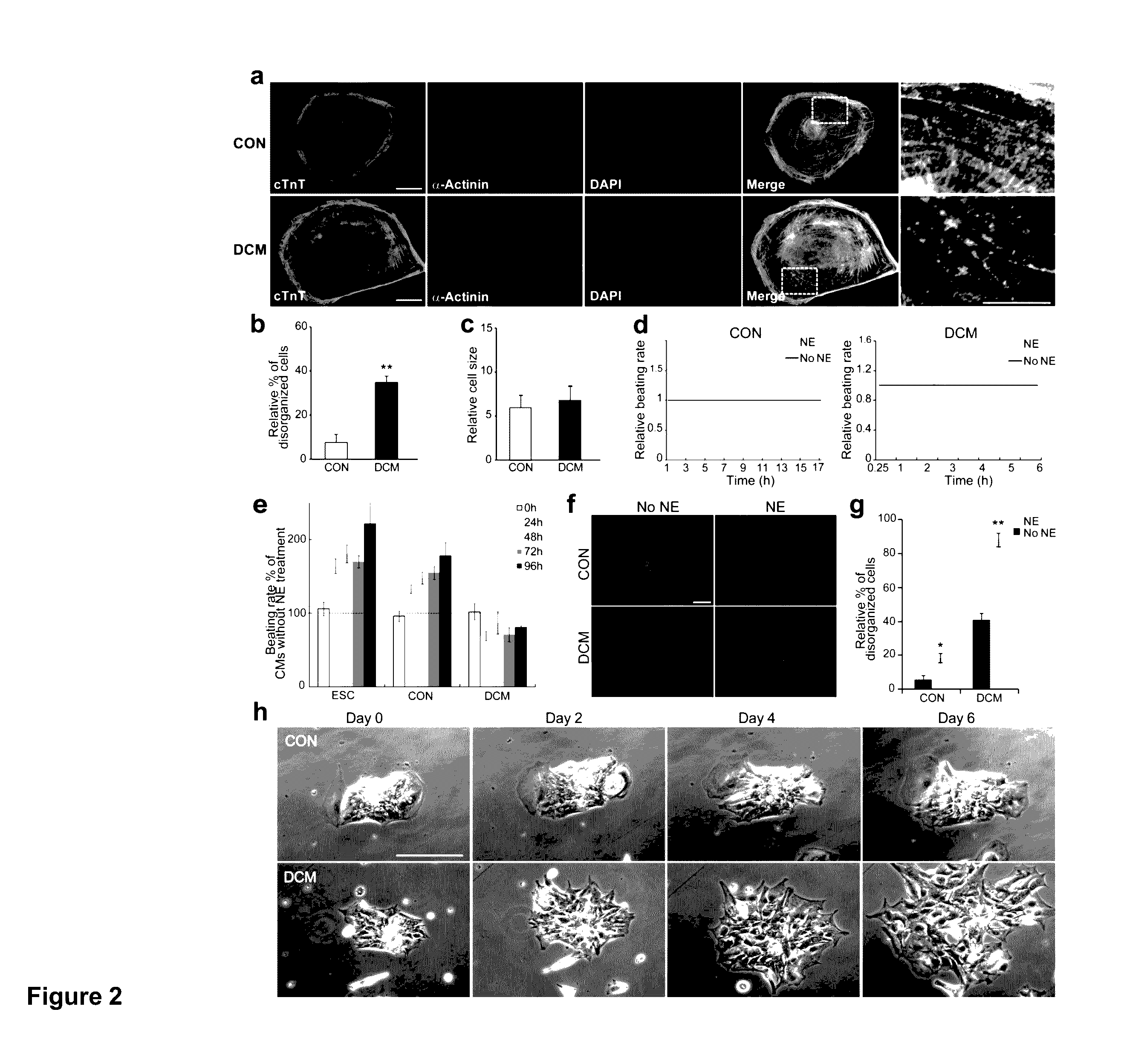 Cardiomyocytes From Induced Pluripotent Stem Cells From Patients and Methods of Use Thereof