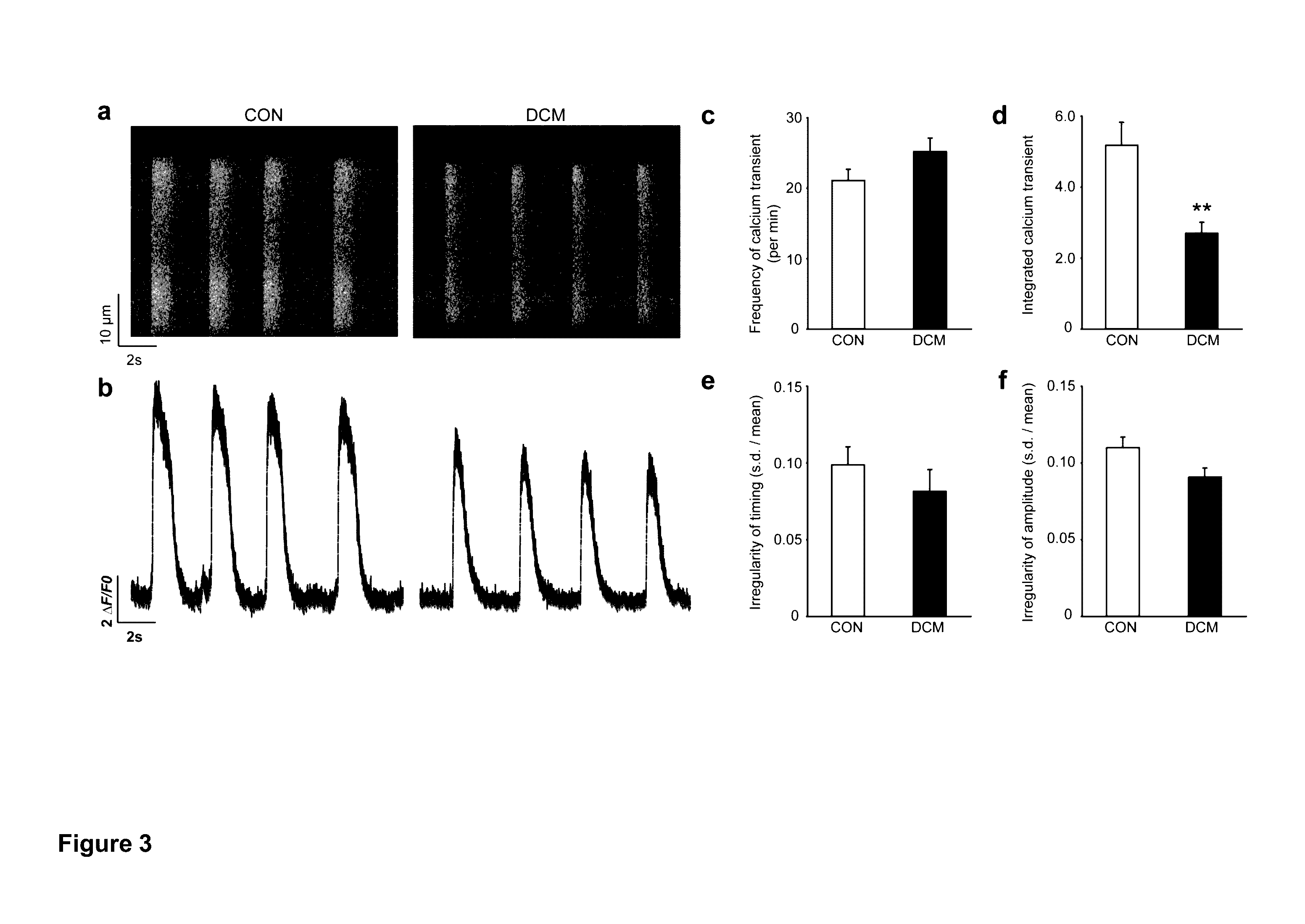 Cardiomyocytes From Induced Pluripotent Stem Cells From Patients and Methods of Use Thereof