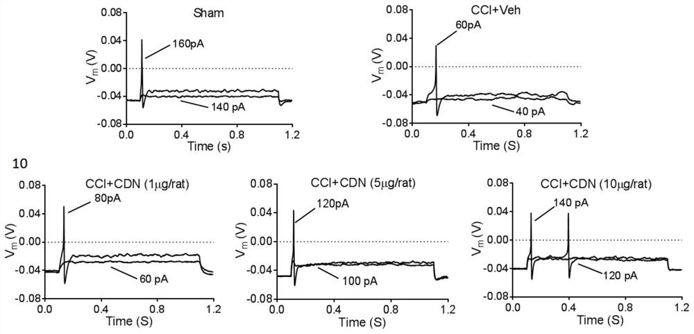 Application of CDN1163 in preparation of medicine for relieving or treating neuropathic pain