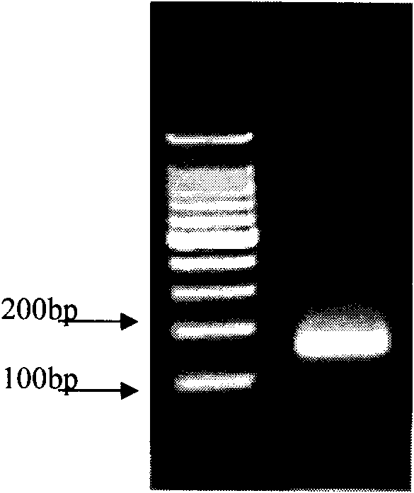 Method for preparing human chromosome P16 gene probe and application thereof