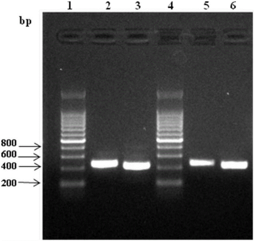 Anti-C-reactive-protein antibodies and application thereof