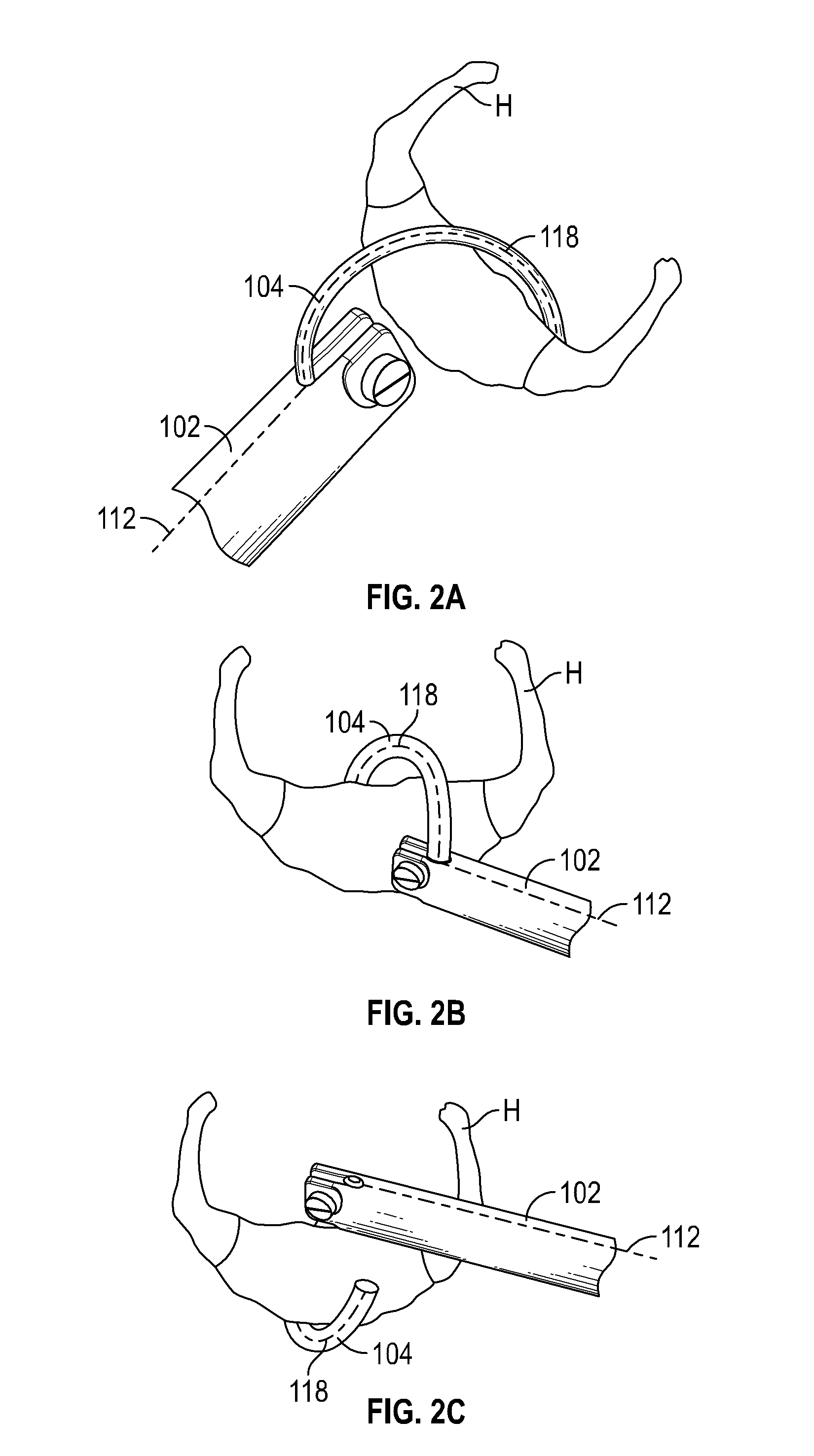 Systems and methods for tissue suspension and compression