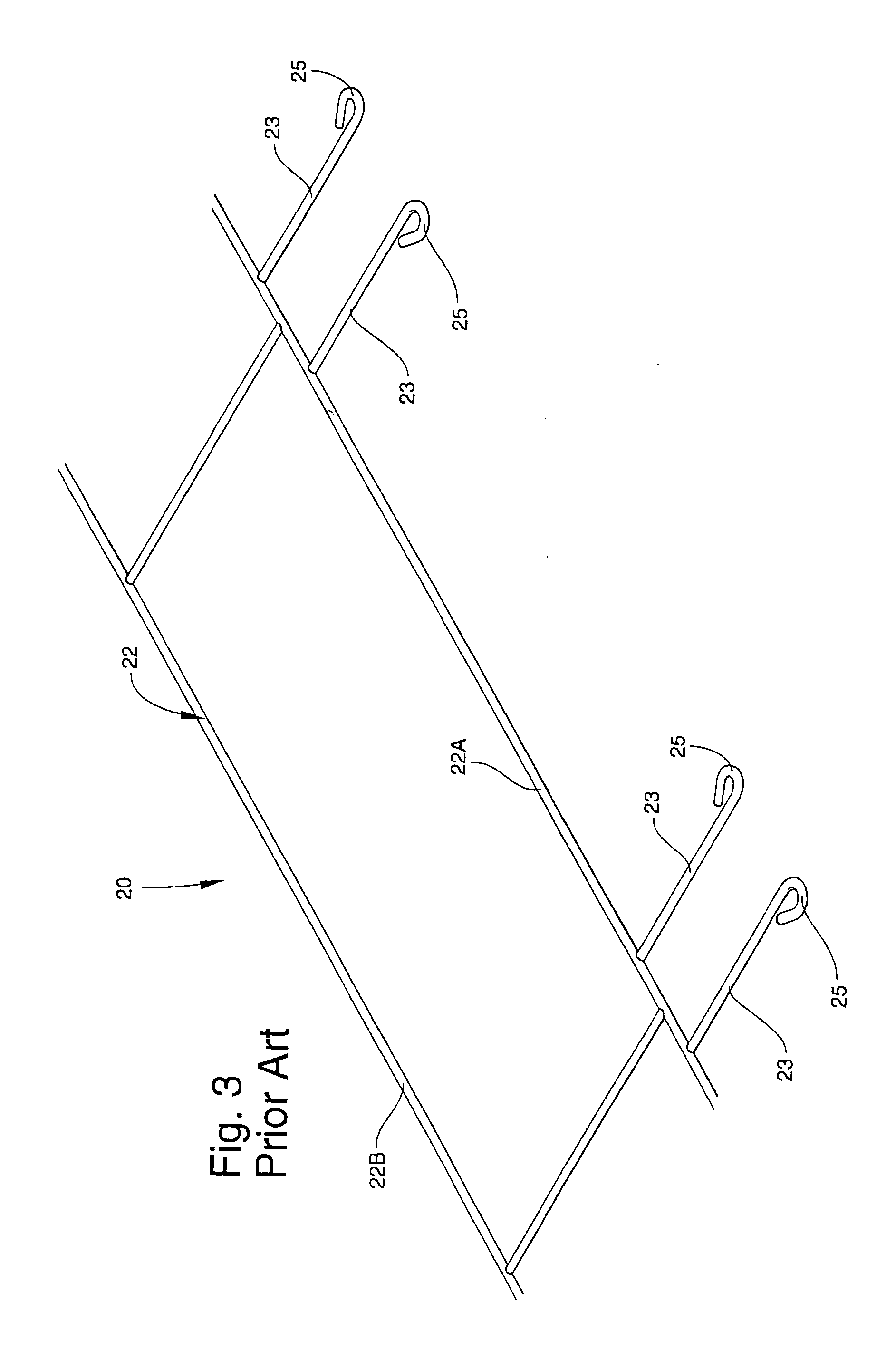 Masonry anchoring system