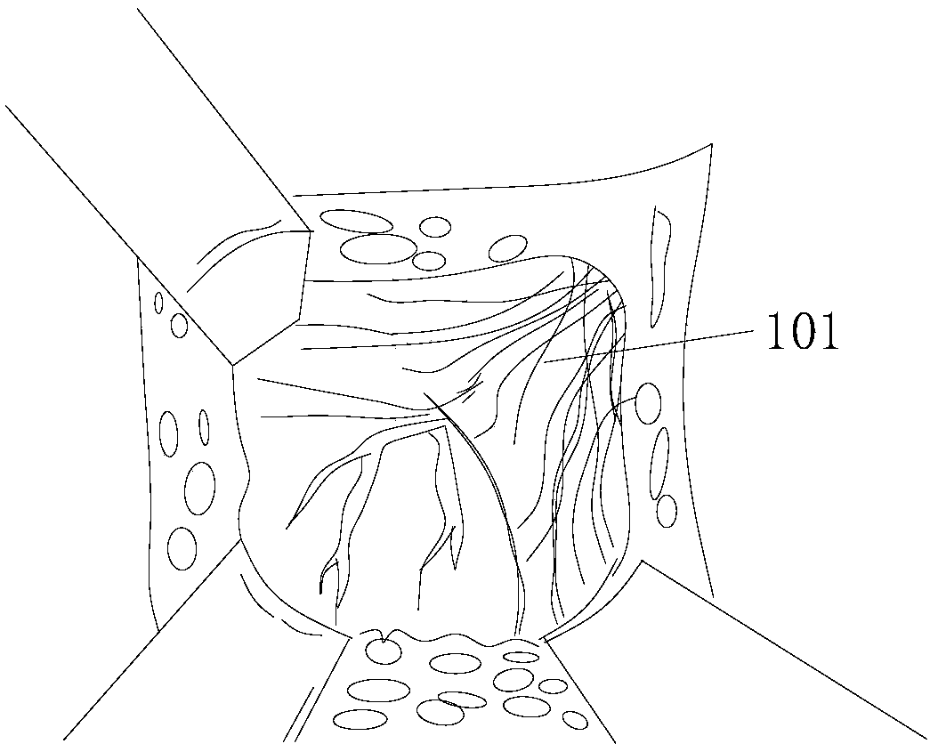 Laparoscopic-assisted binding ligator for treating prostate back side venous plexuses and application