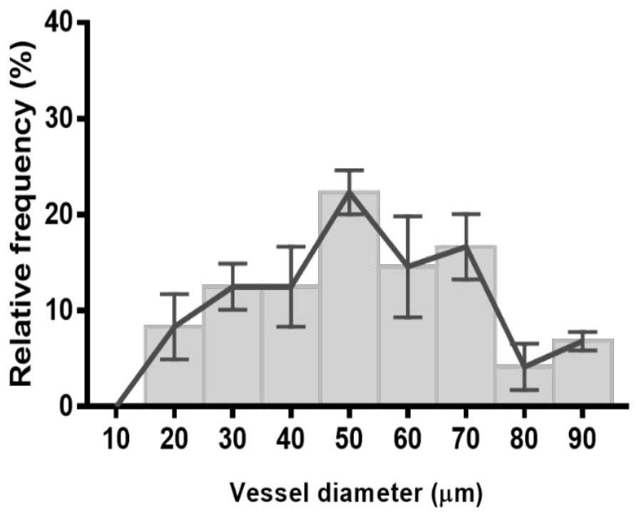 Characterization of mir-9 overexpressing tumors and their treatment and specific markers