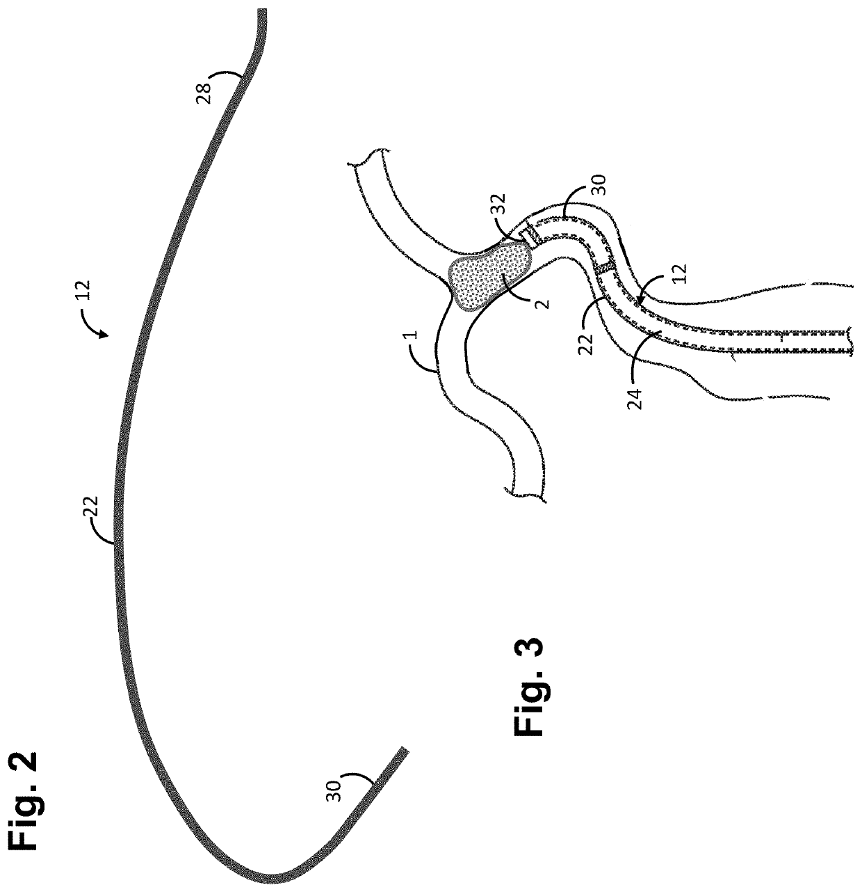Mechanically resonant pulse relief valve for assisted clearing of plugged aspiration