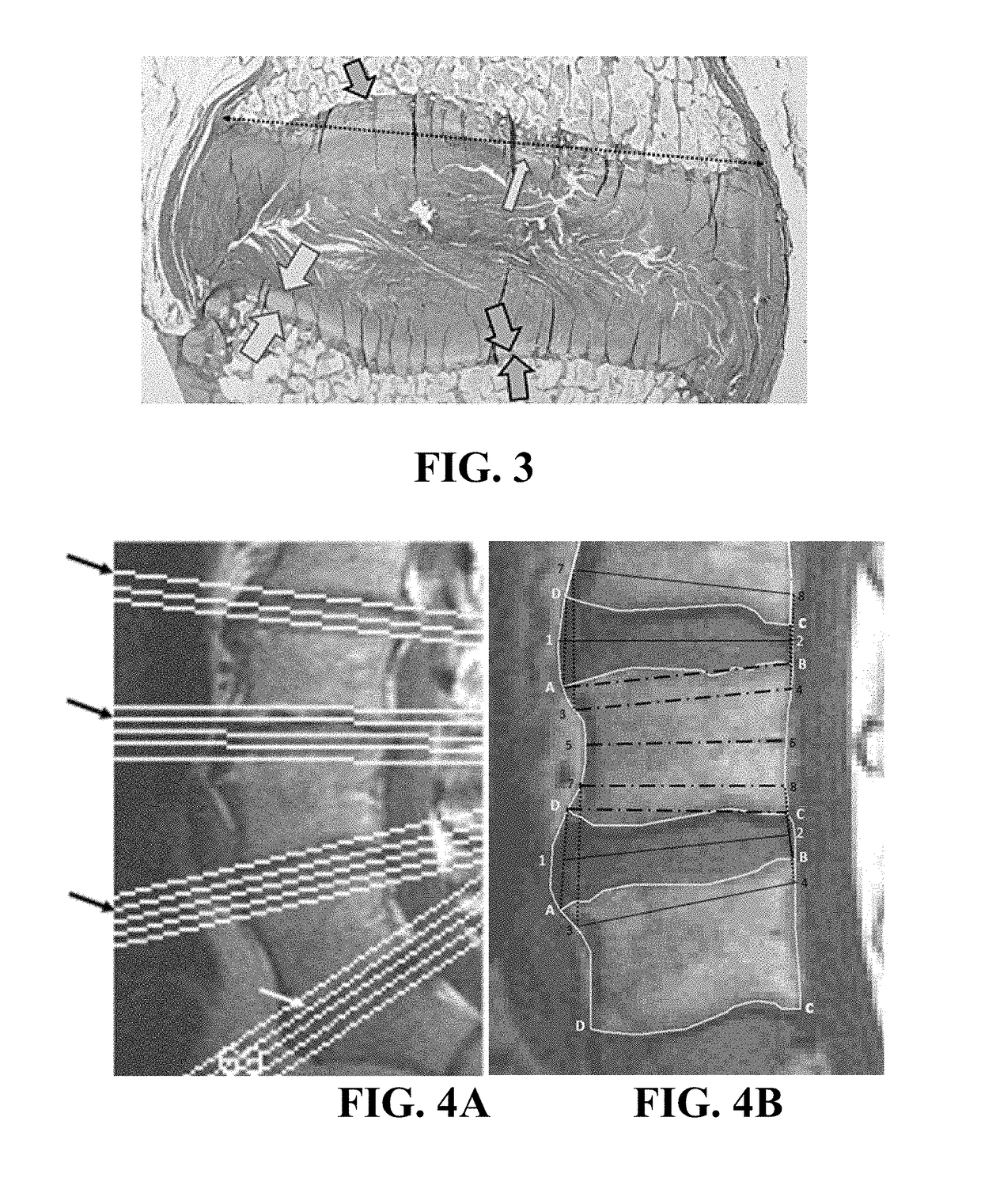 Systems and methods for identification and prediction of structural spine pain