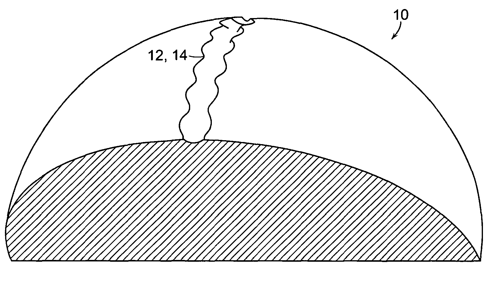 Golf ball surface patterns comprising variable width/depth multiple channels