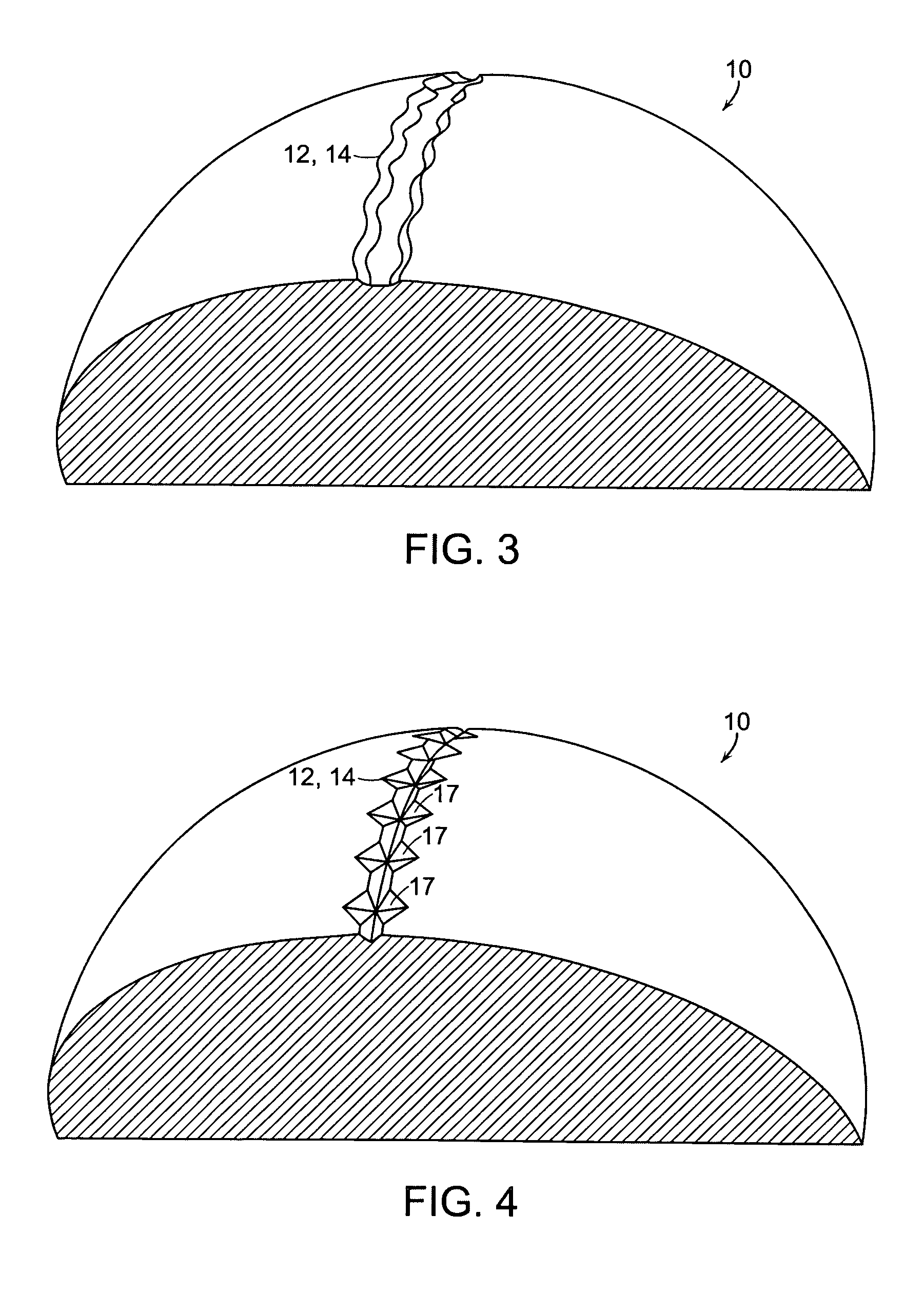 Golf ball surface patterns comprising variable width/depth multiple channels
