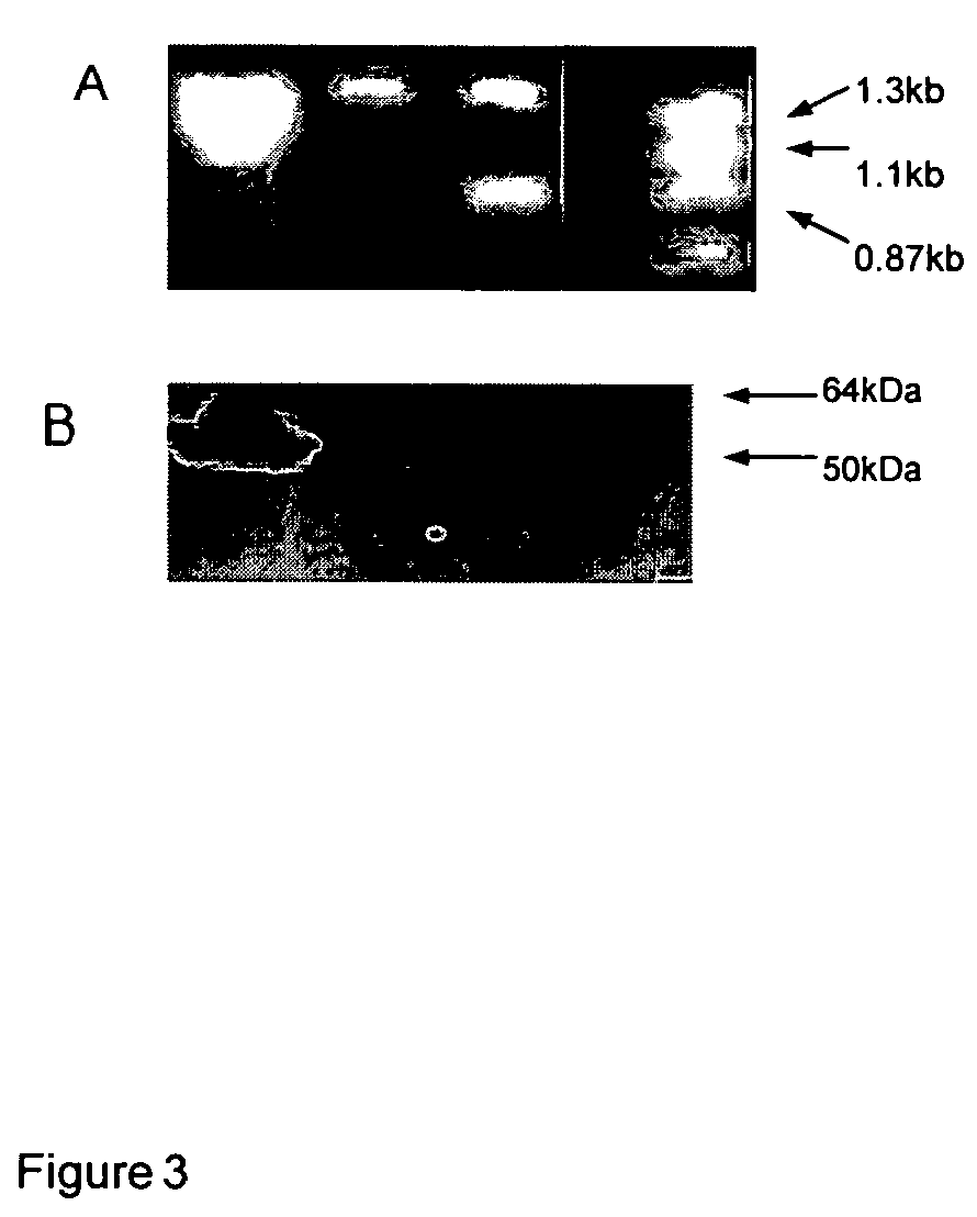 Recombinant poxvirus for chimeric proteins of the human immunodeficiency virus