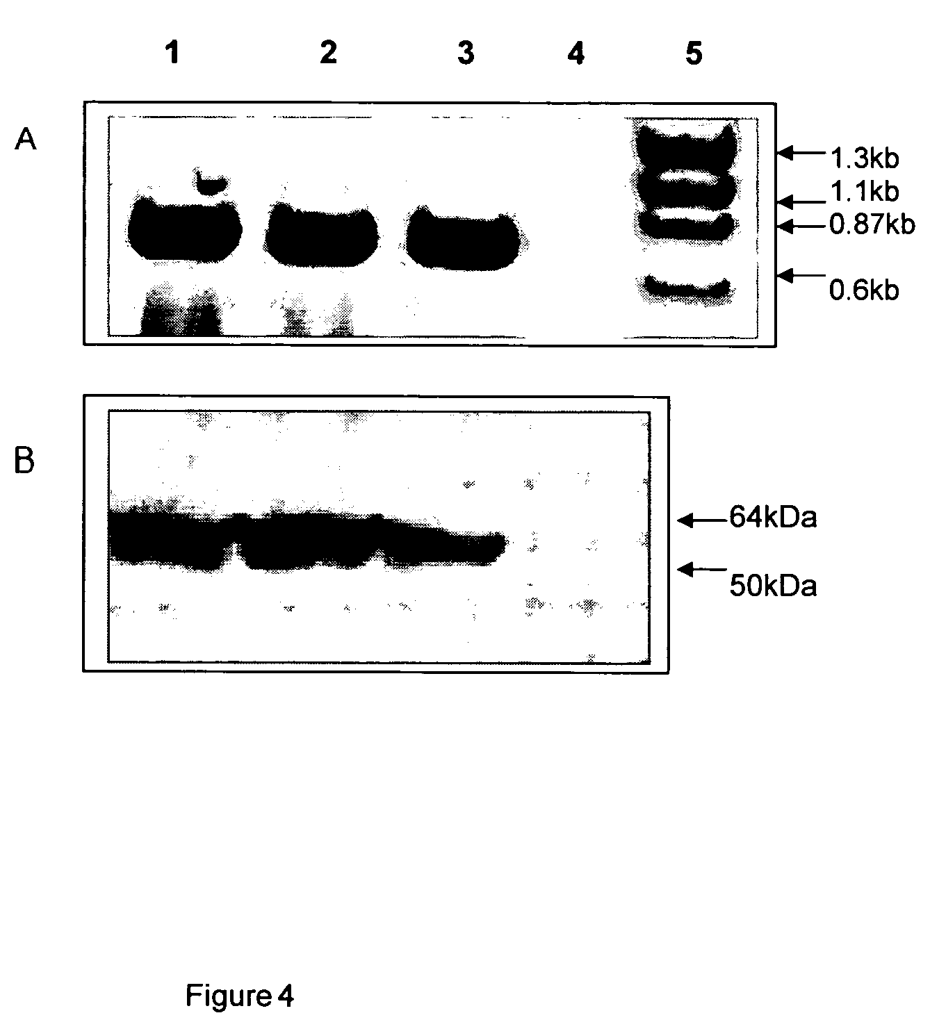 Recombinant poxvirus for chimeric proteins of the human immunodeficiency virus