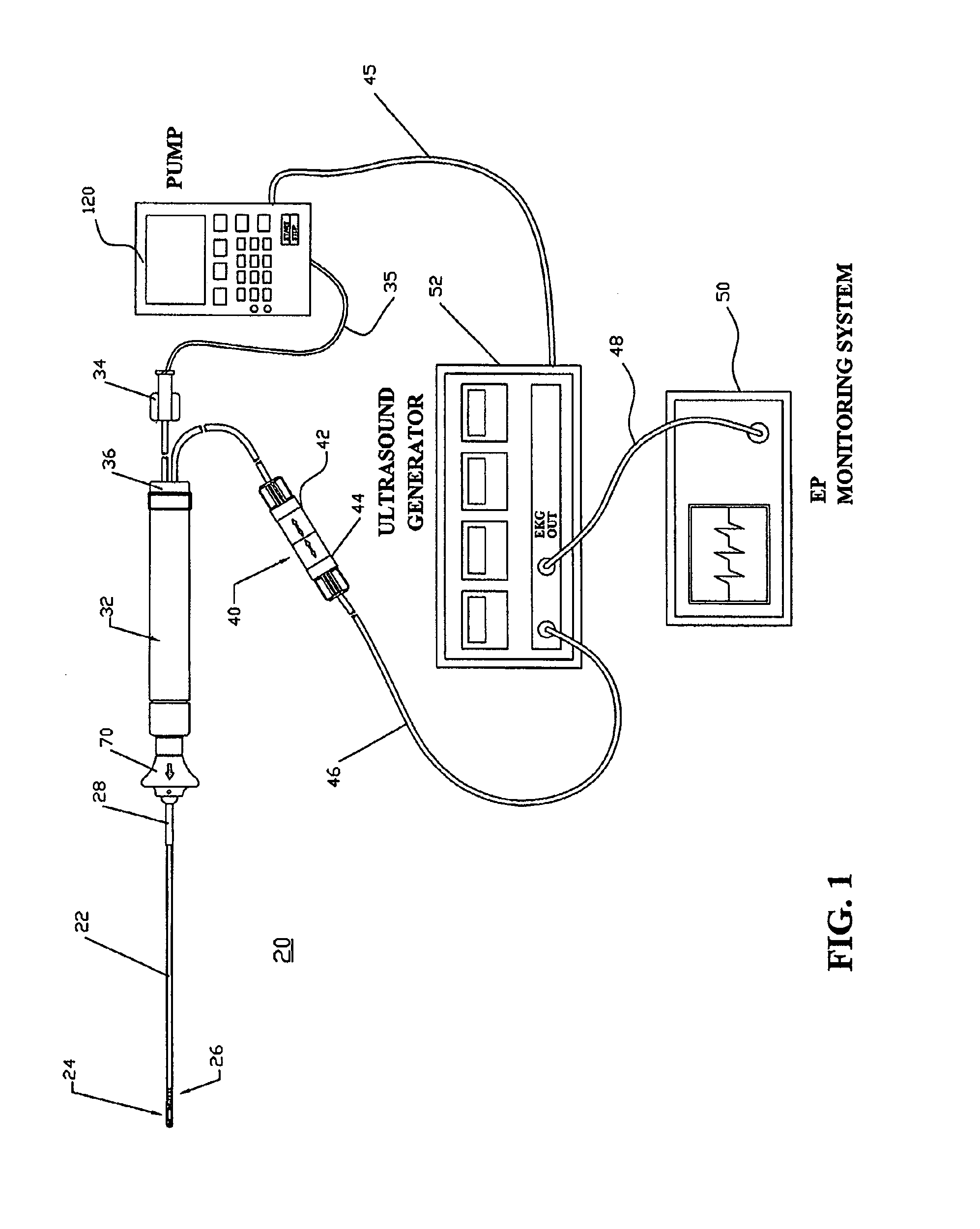 Ultrasound ablation apparatus with discrete staggered ablation zones